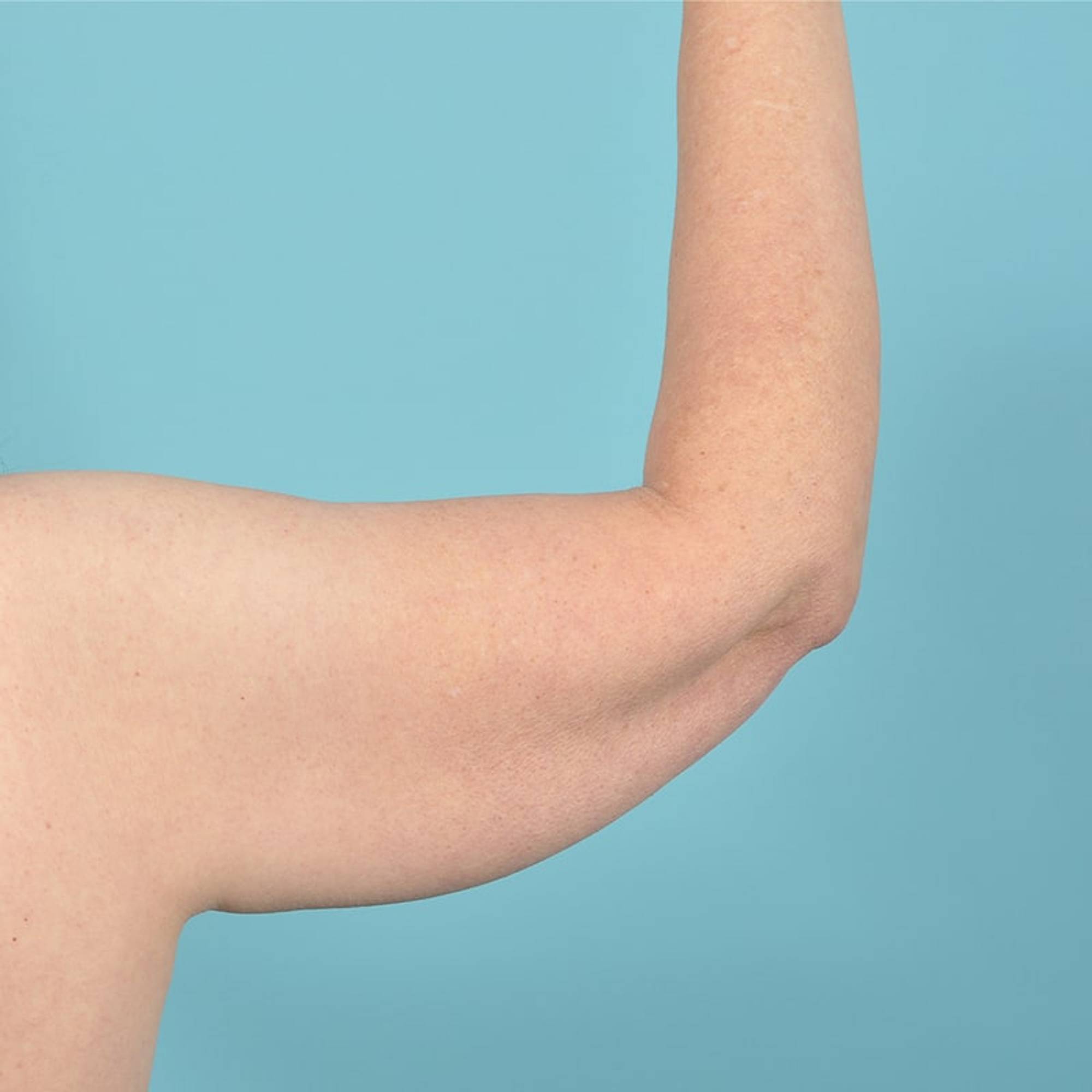  Before & After Image