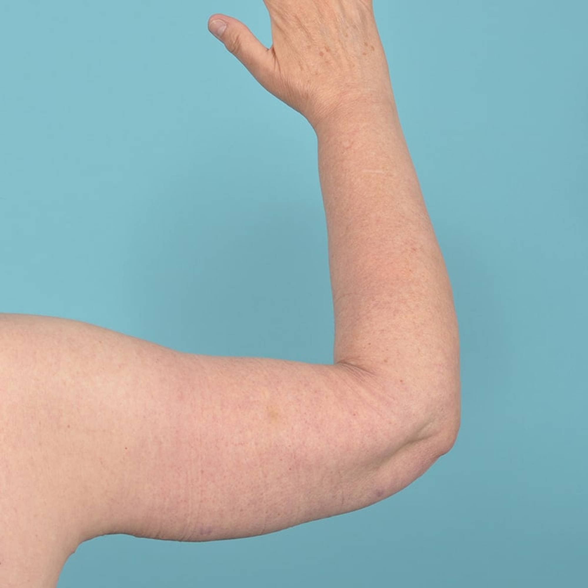  Before & After Image