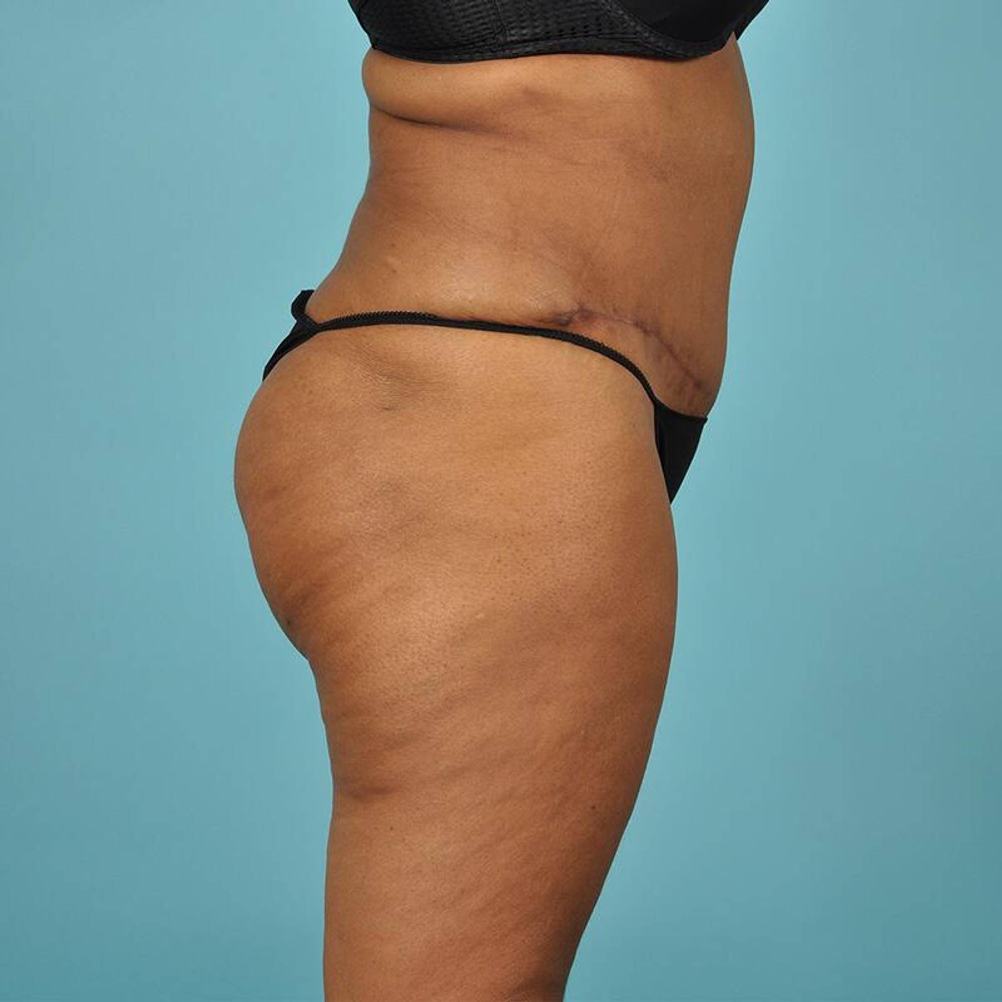  Before & After Image