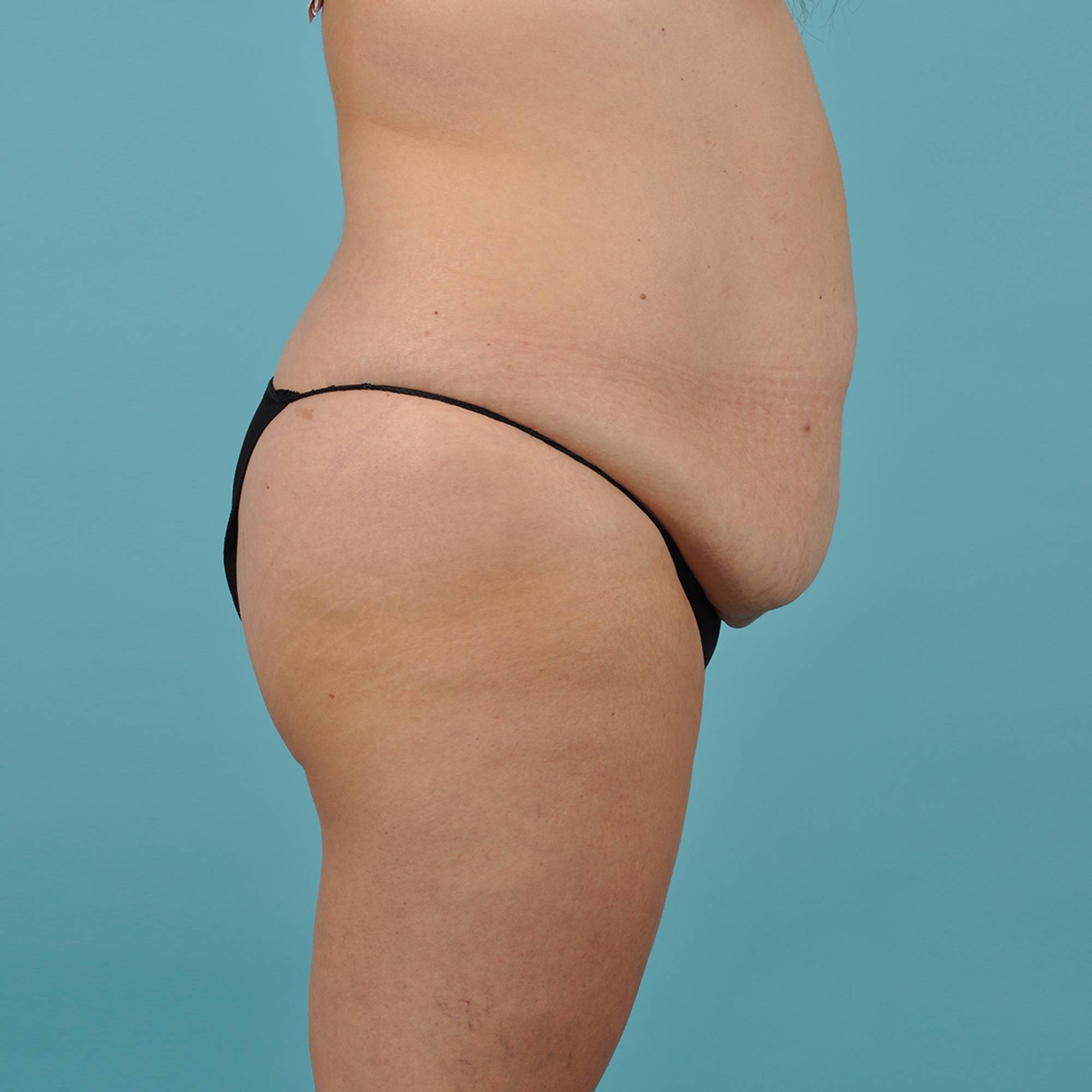  Before & After Image