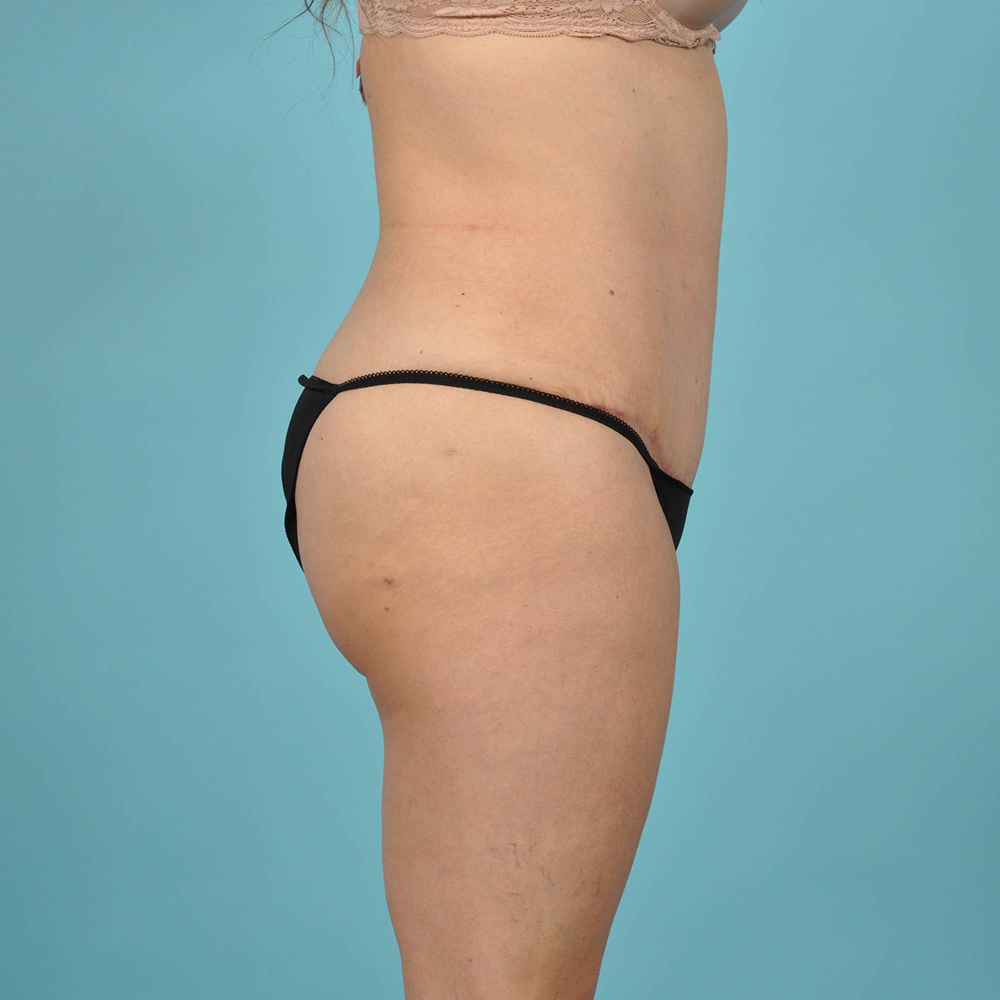  Before & After Image