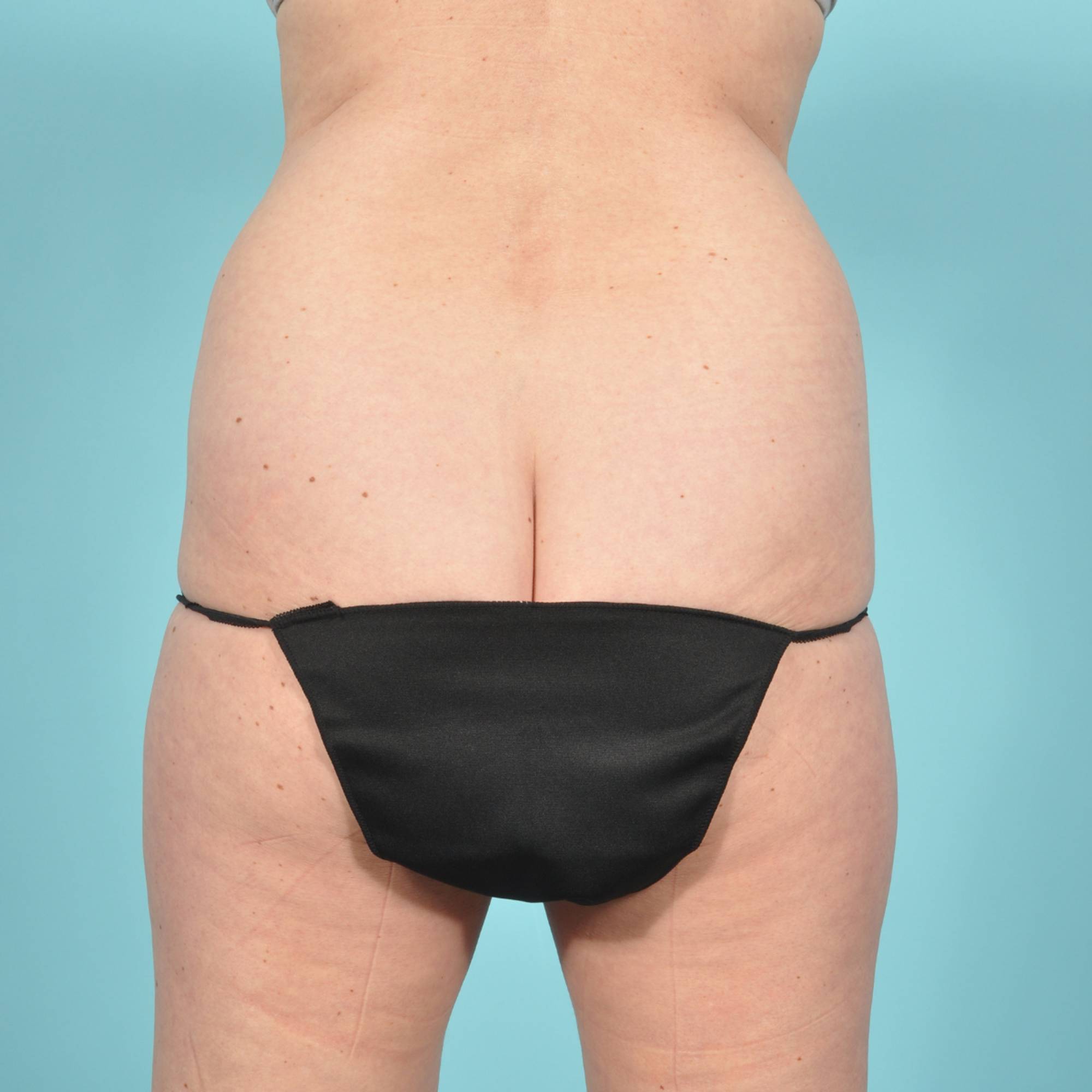  Before & After Image