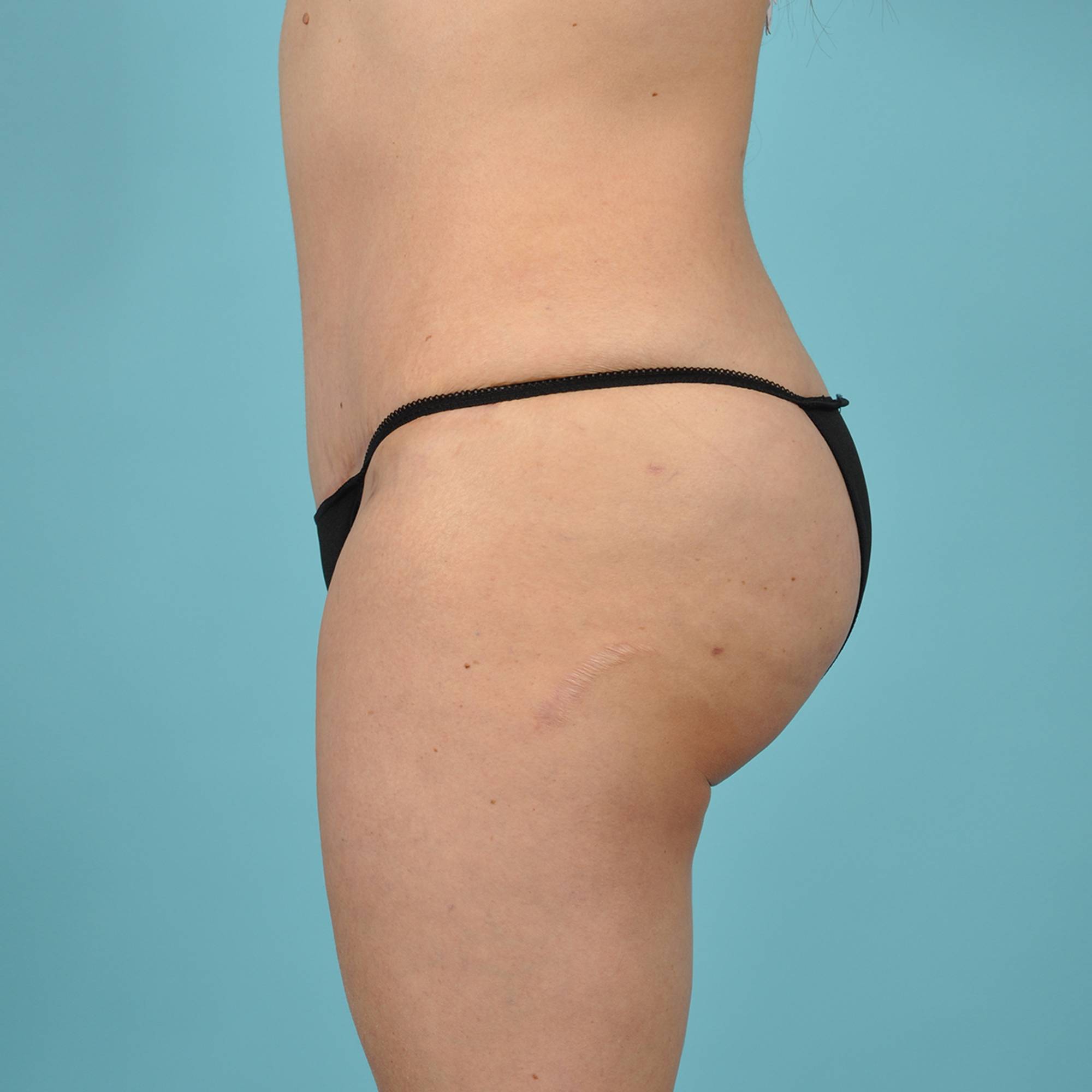  Before & After Image