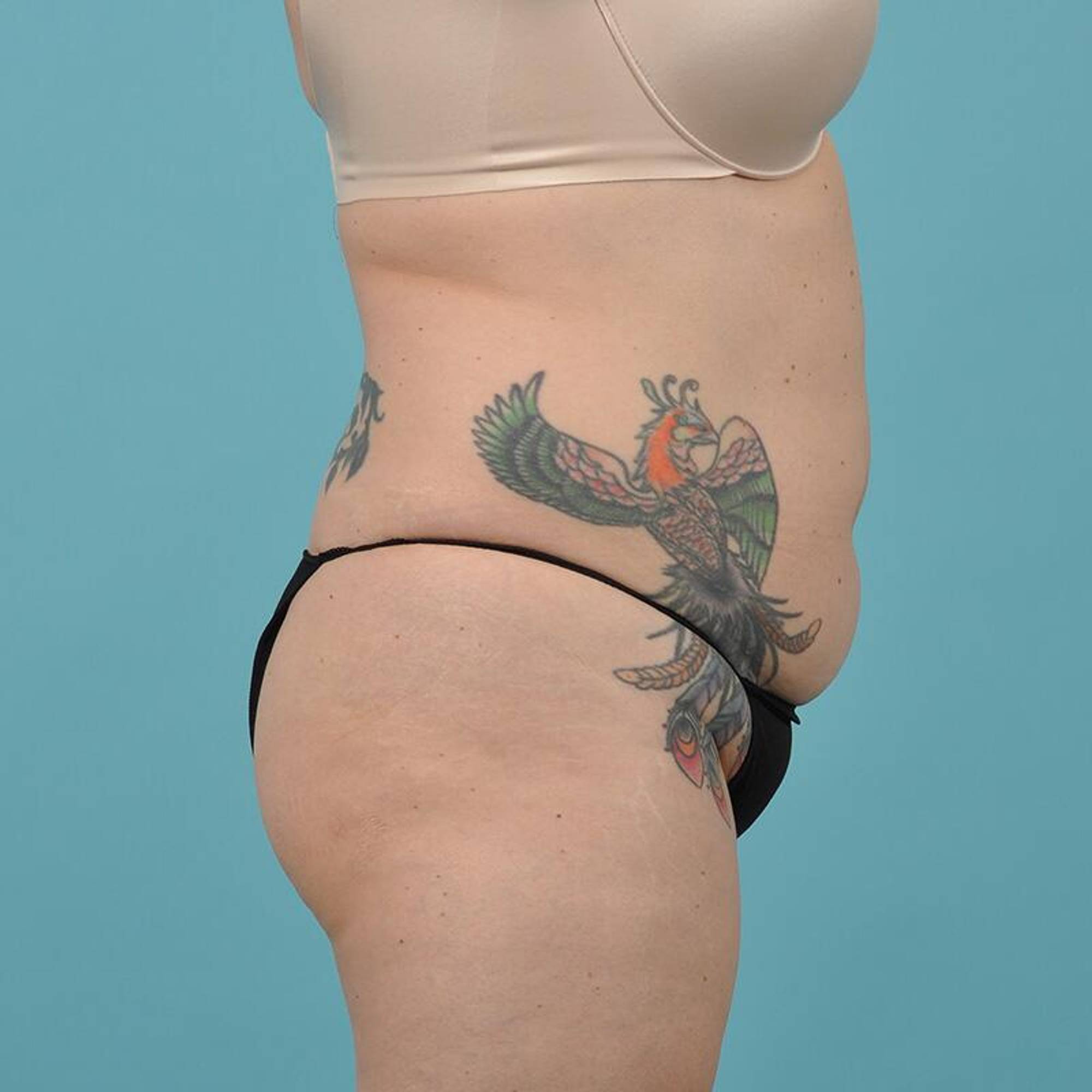  Before & After Image