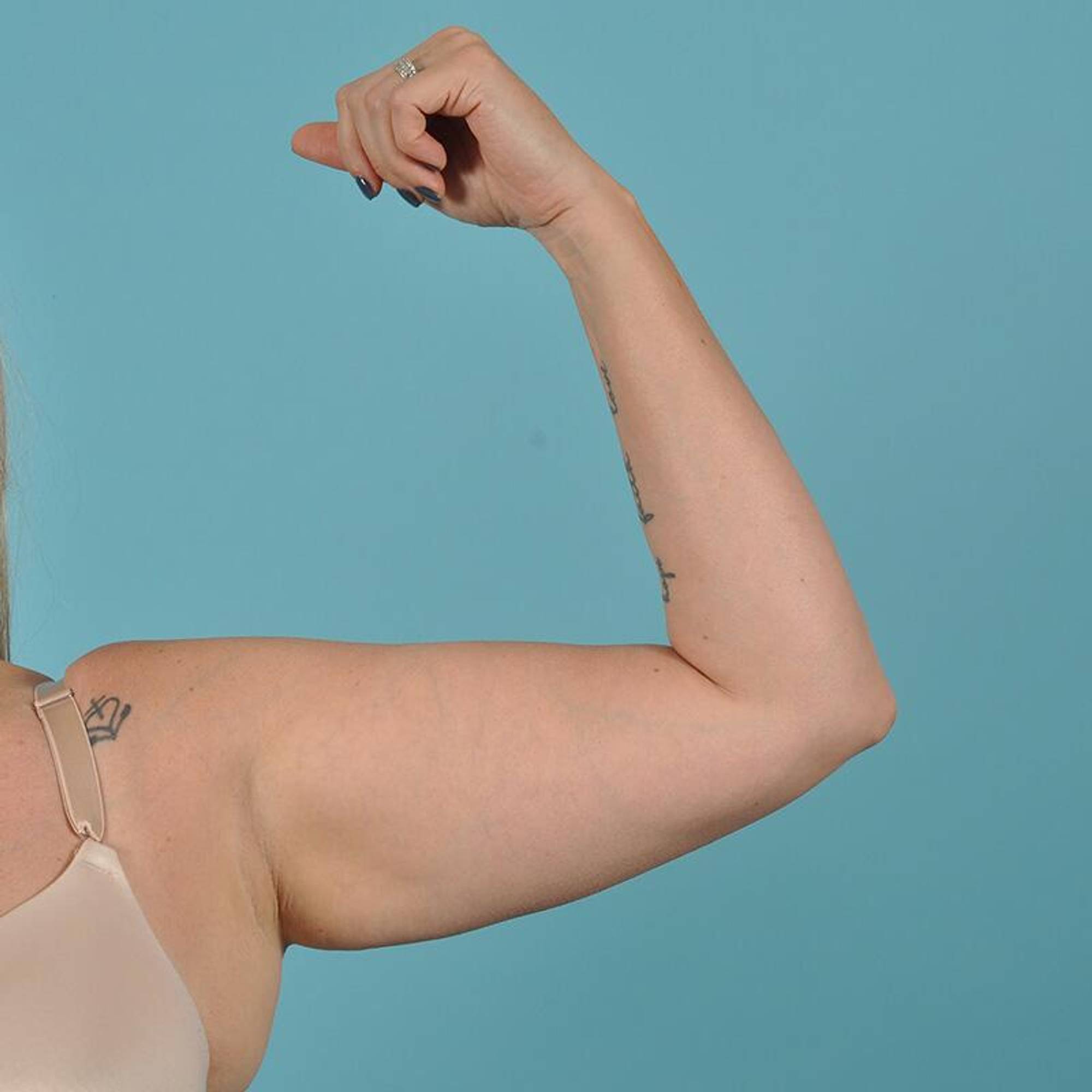  Before & After Image