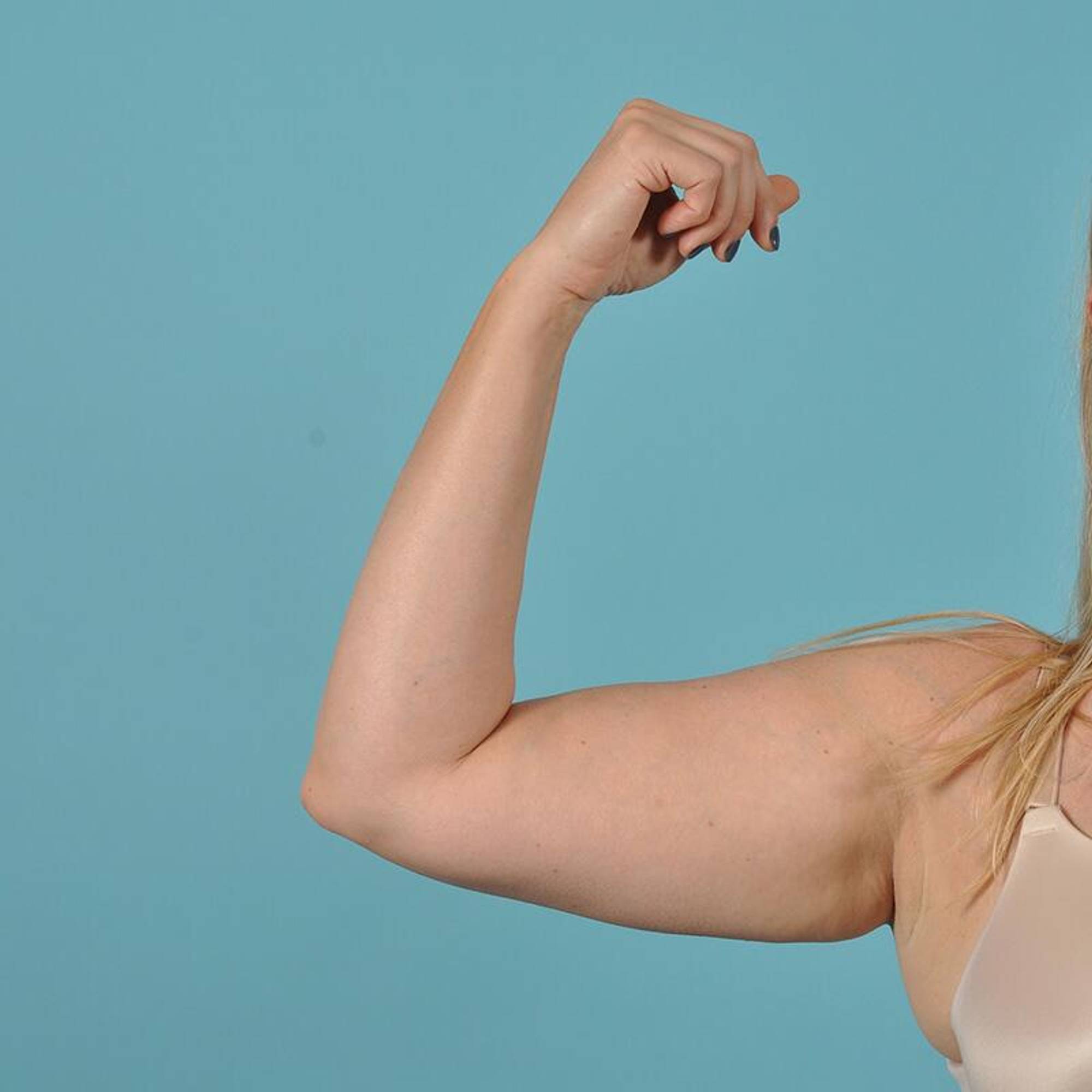  Before & After Image