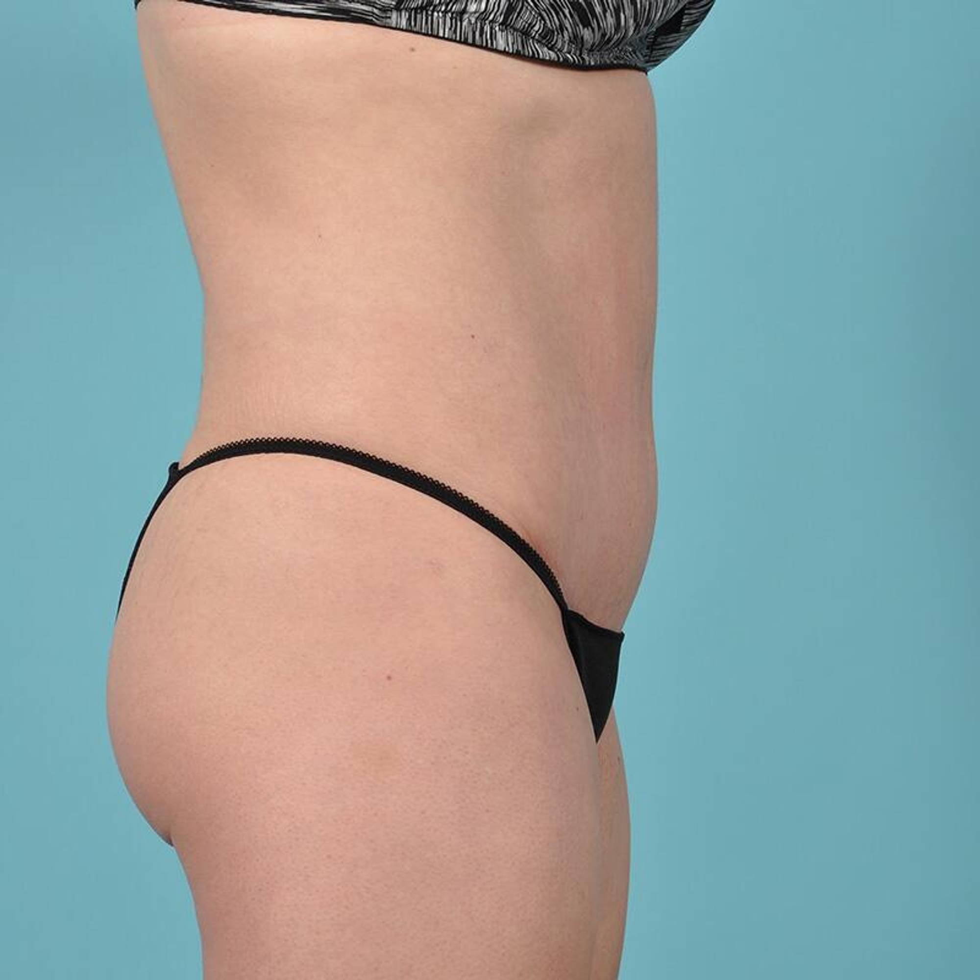  Before & After Image