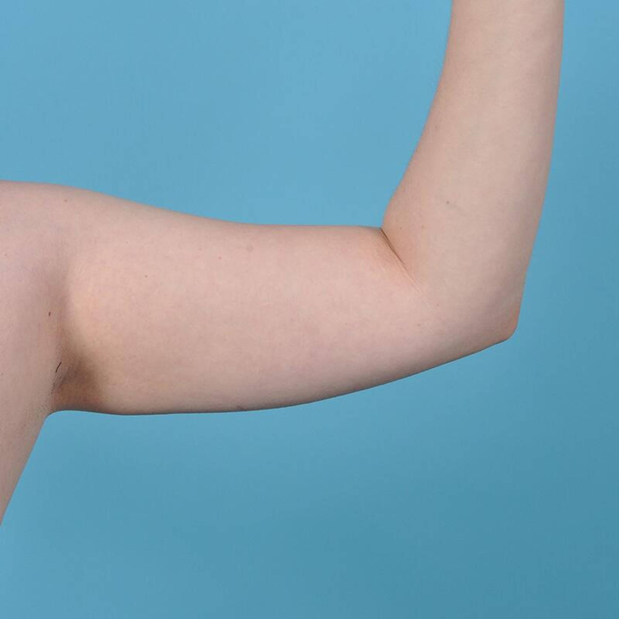  Before & After Image