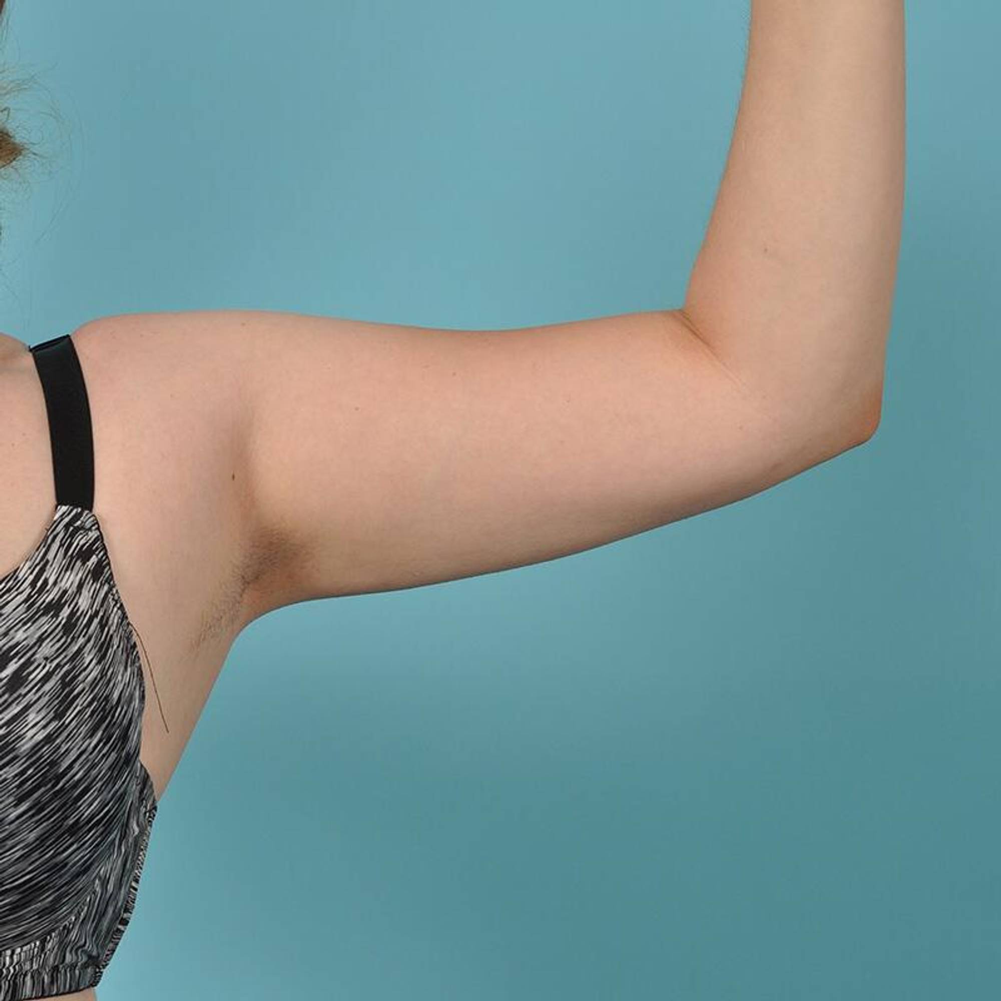  Before & After Image