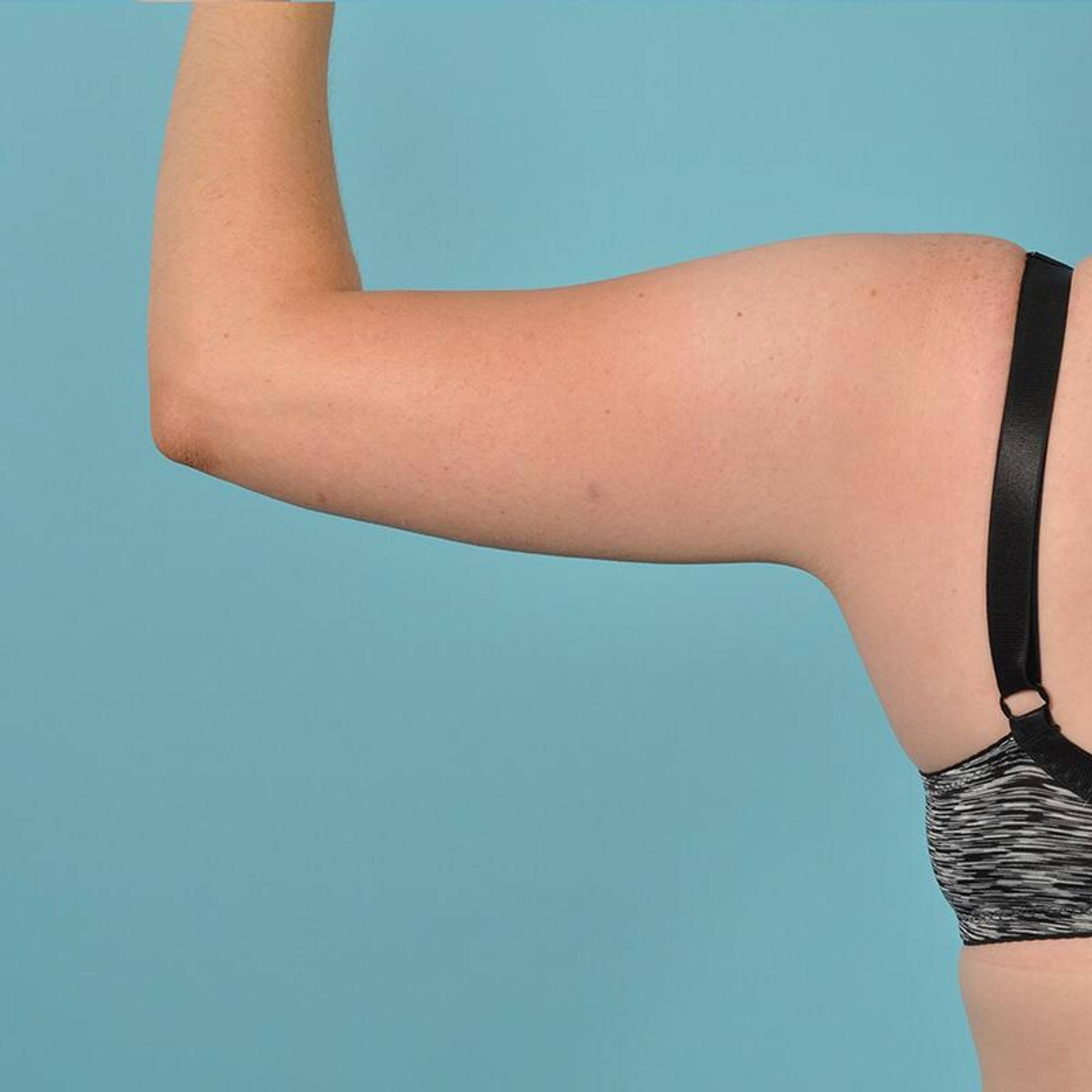  Before & After Image