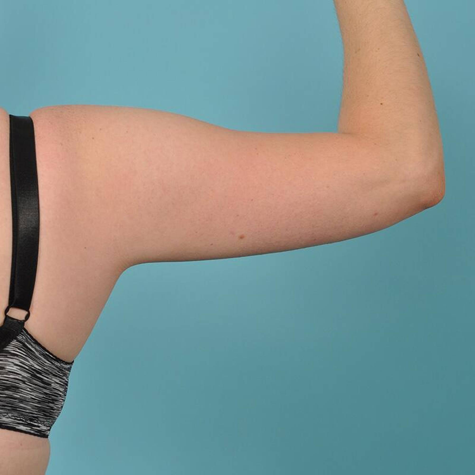  Before & After Image