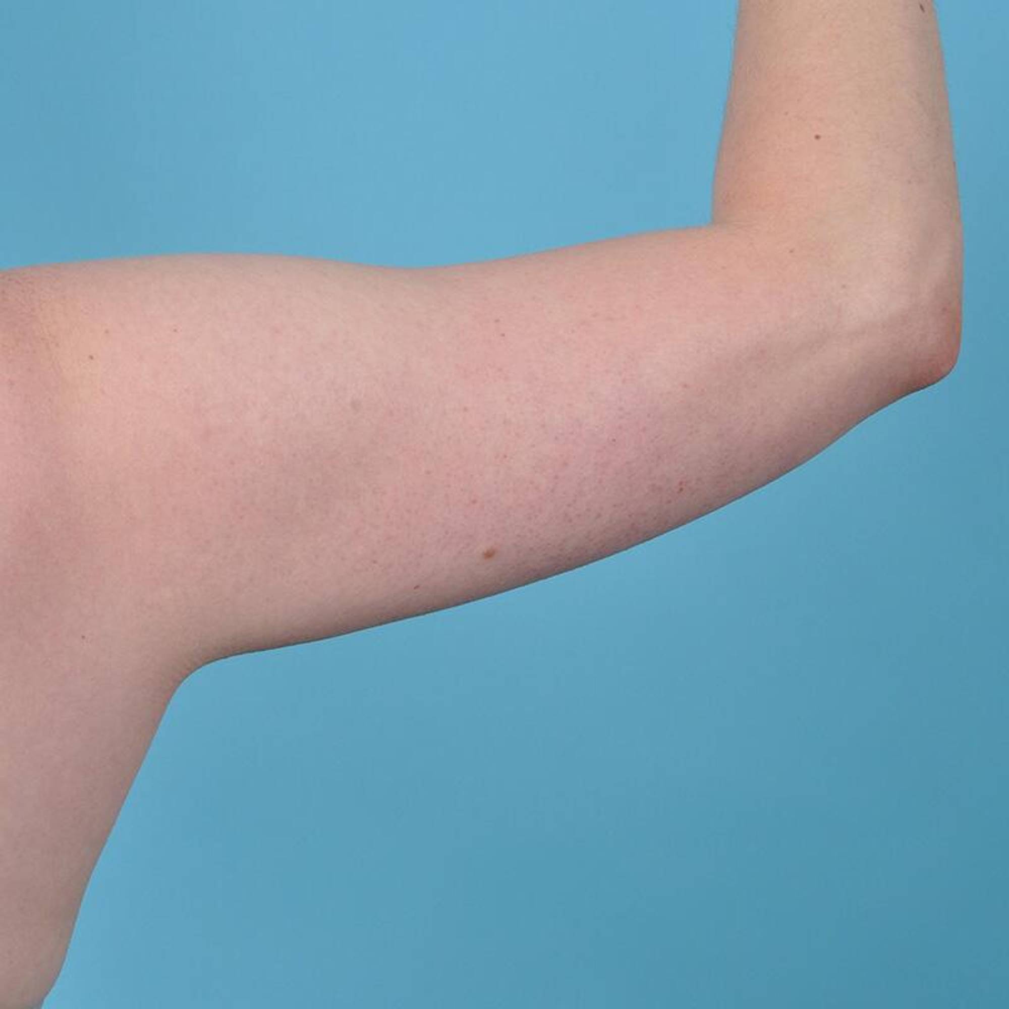  Before & After Image