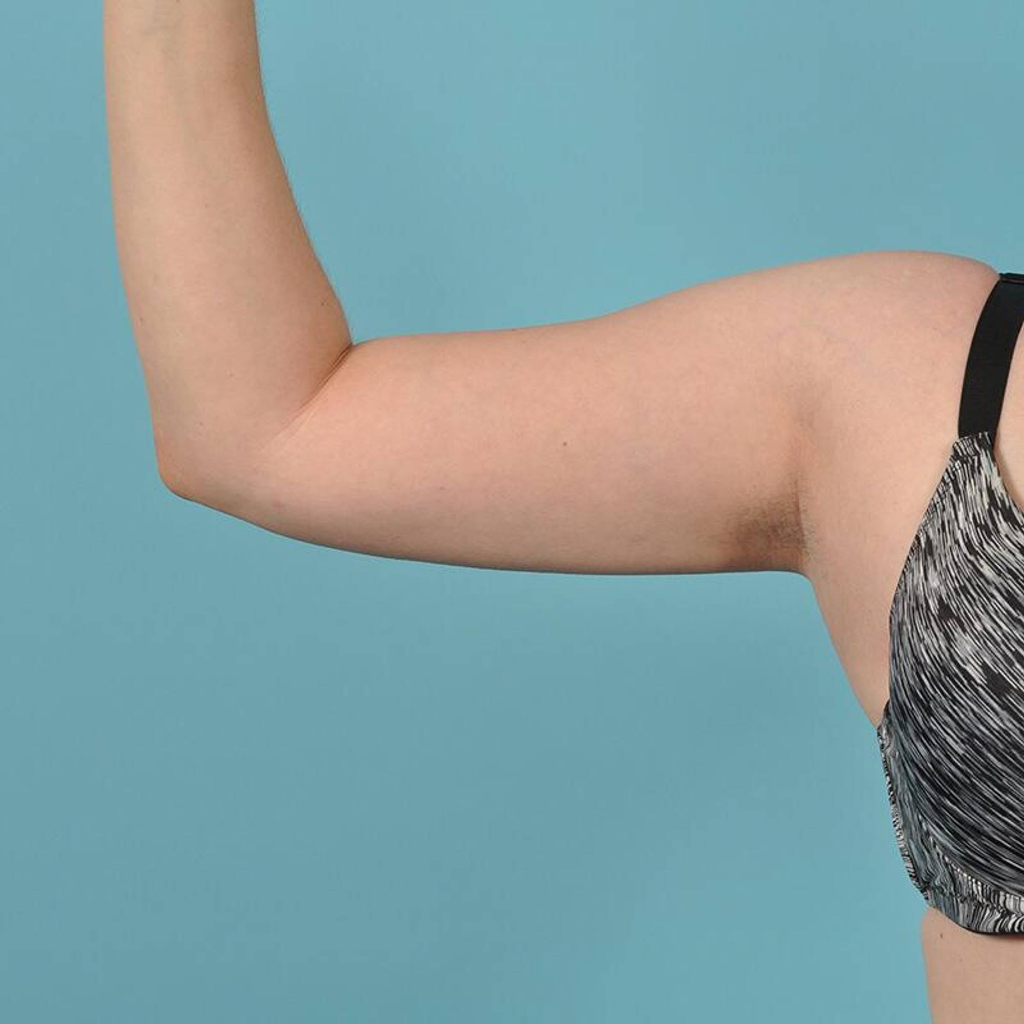  Before & After Image