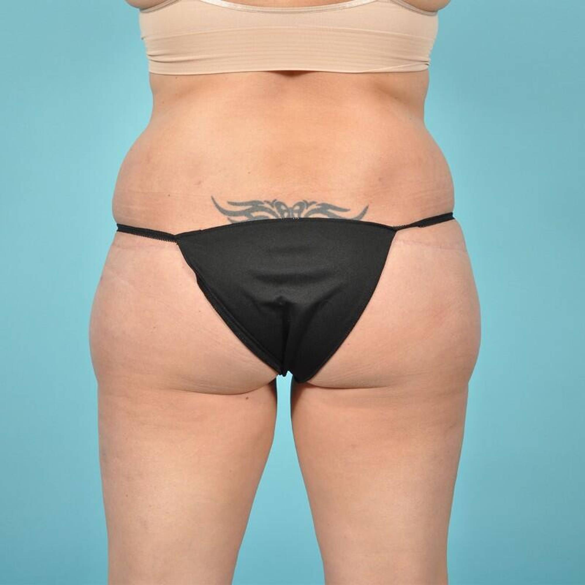  Before & After Image