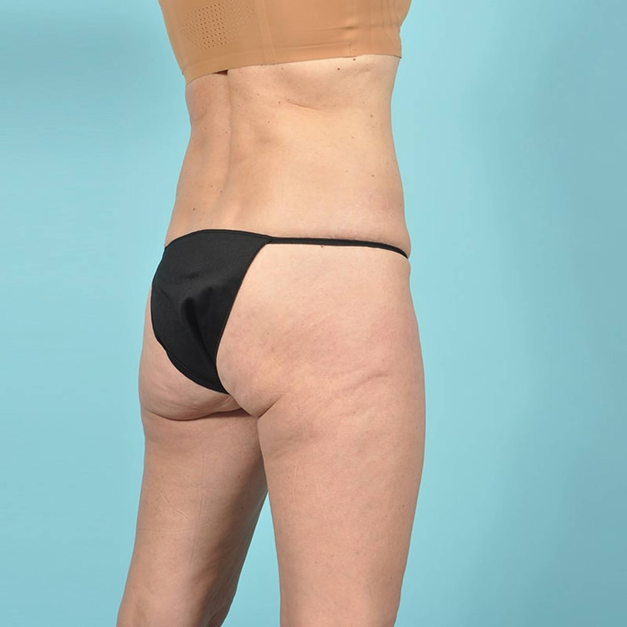  Before & After Image