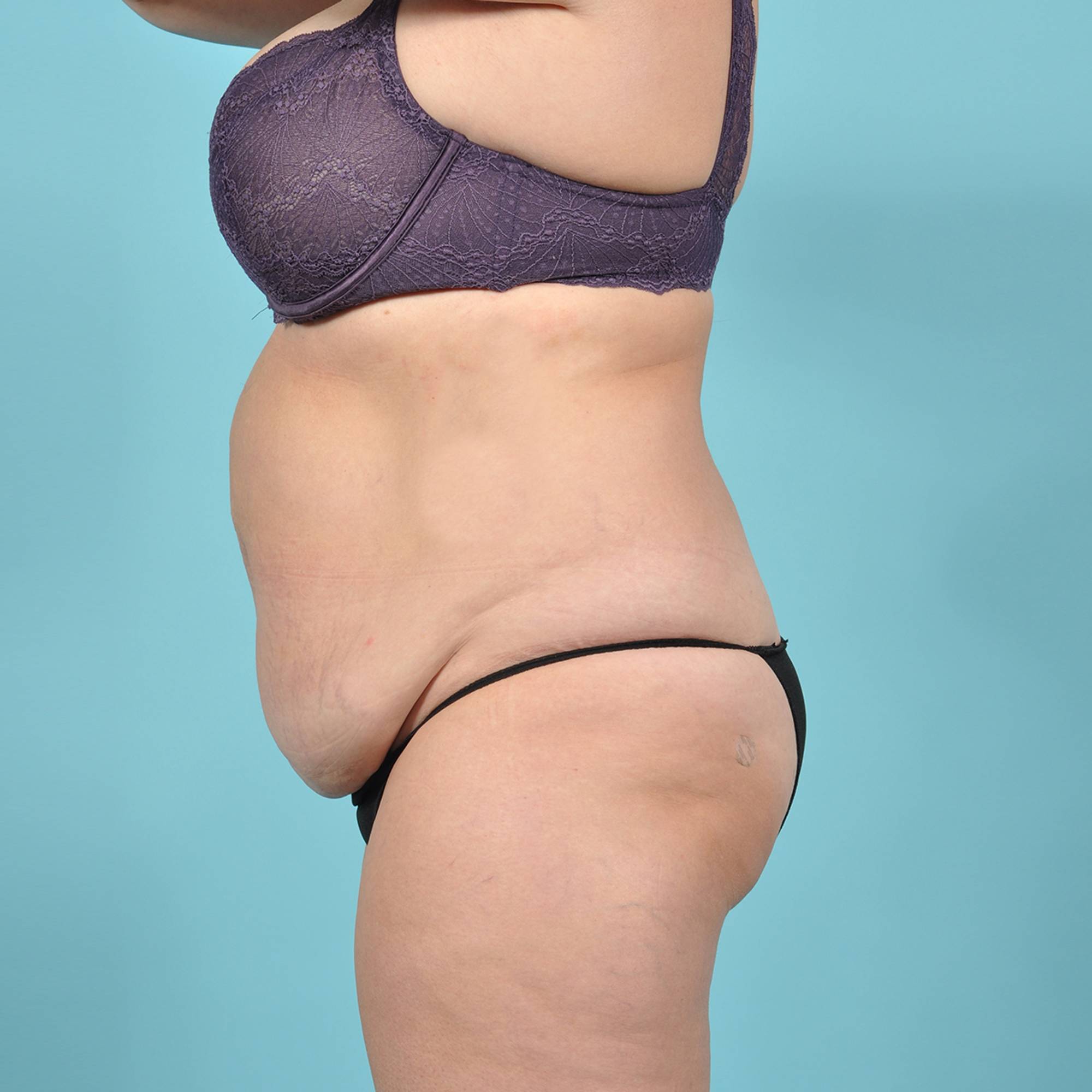  Before & After Image