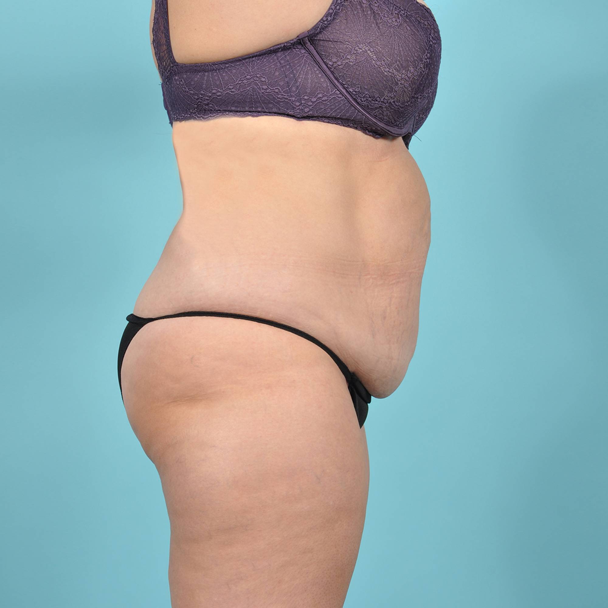  Before & After Image