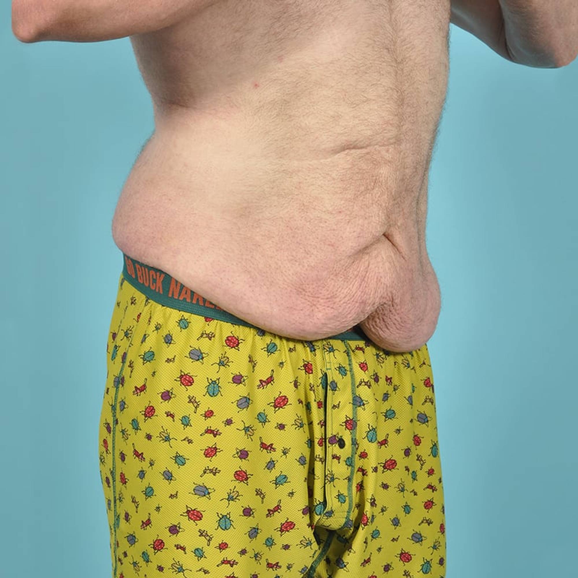  Before & After Image