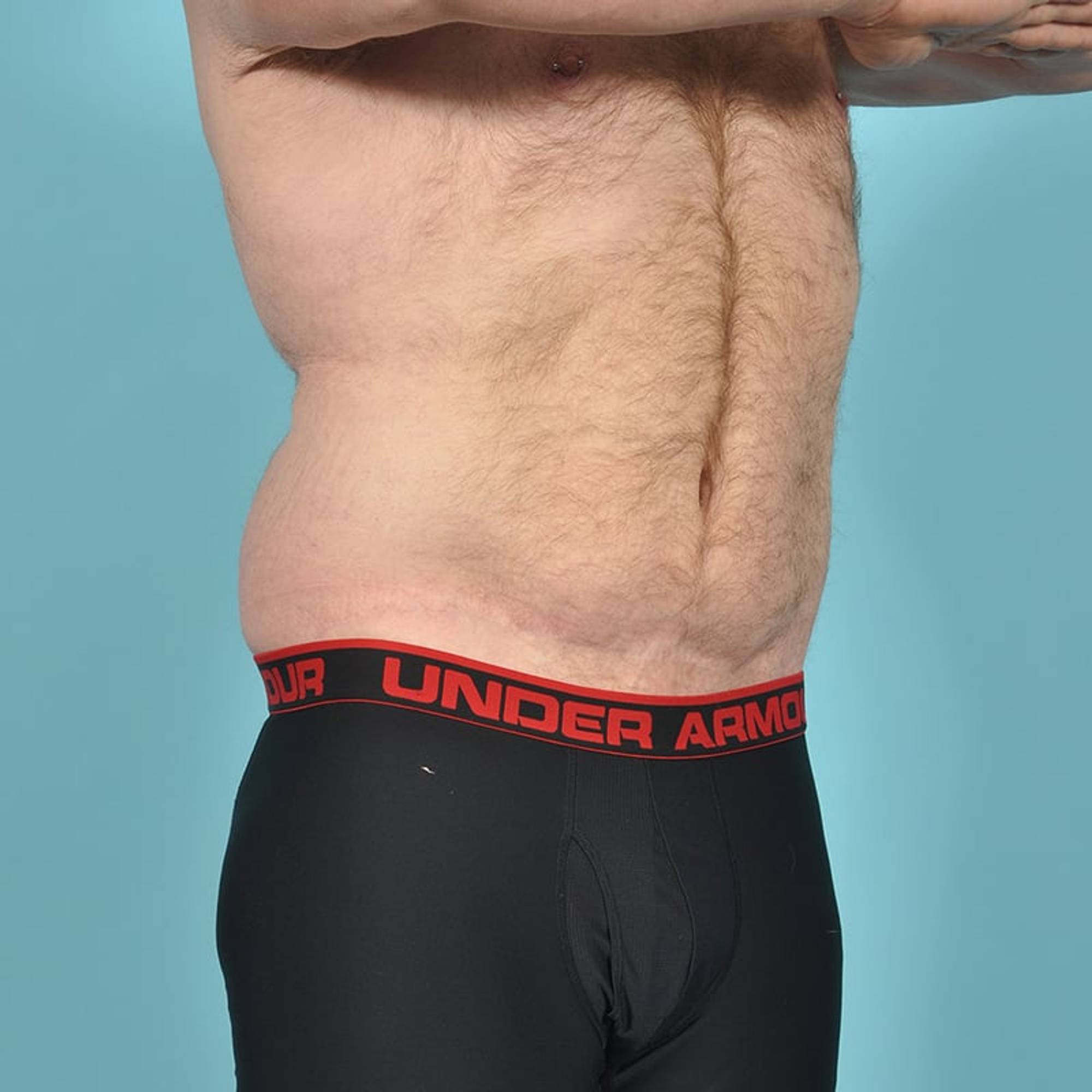  Before & After Image