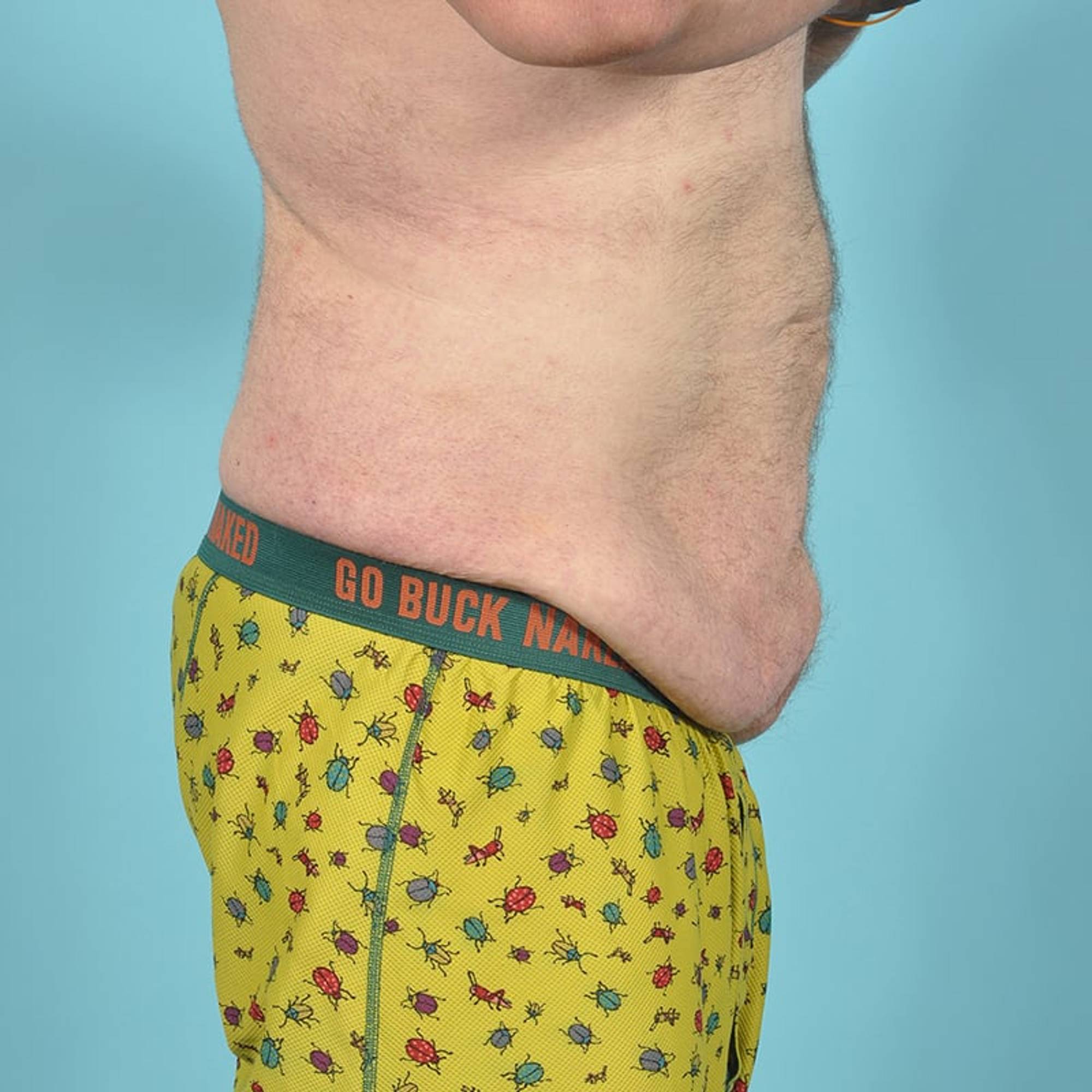  Before & After Image