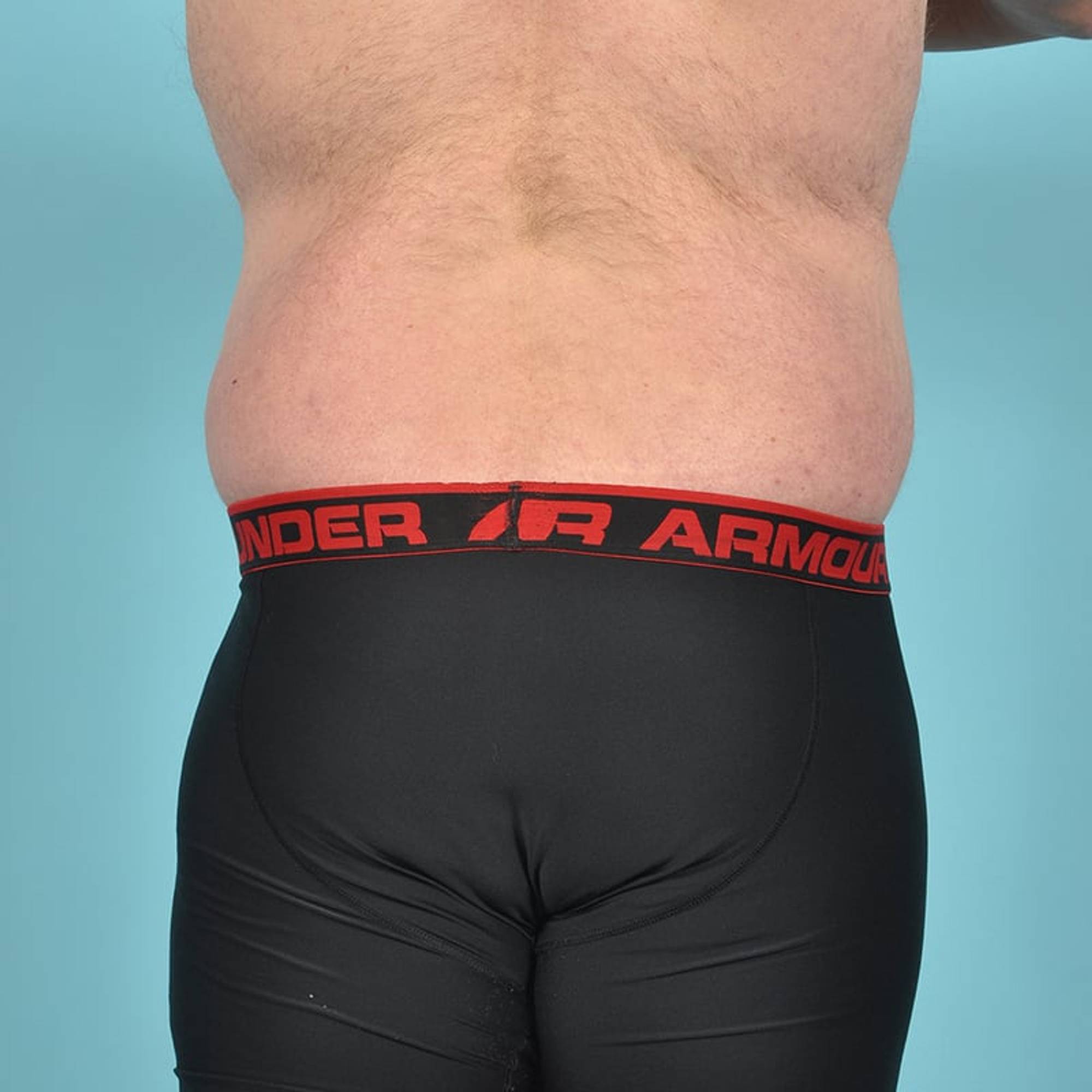  Before & After Image