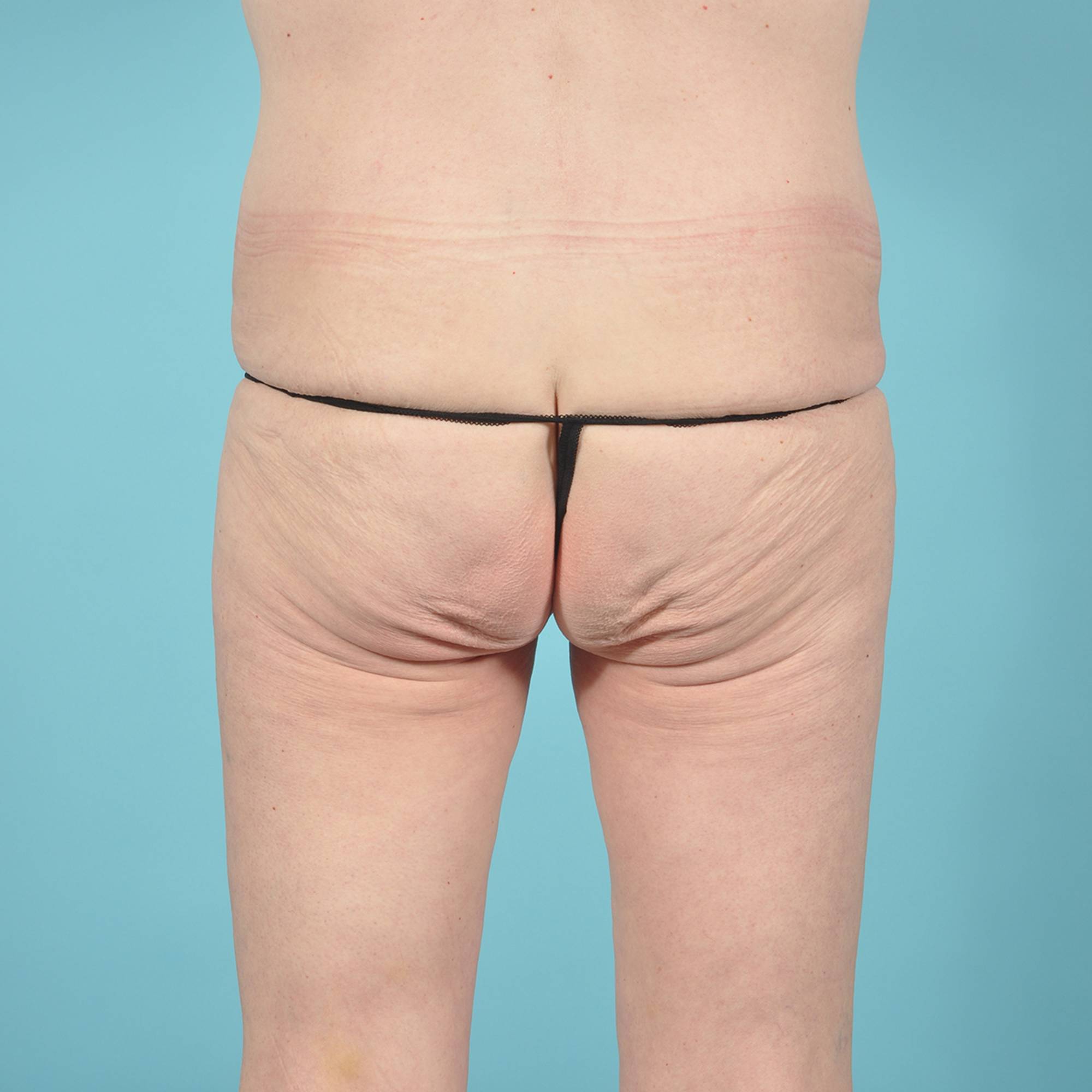  Before & After Image