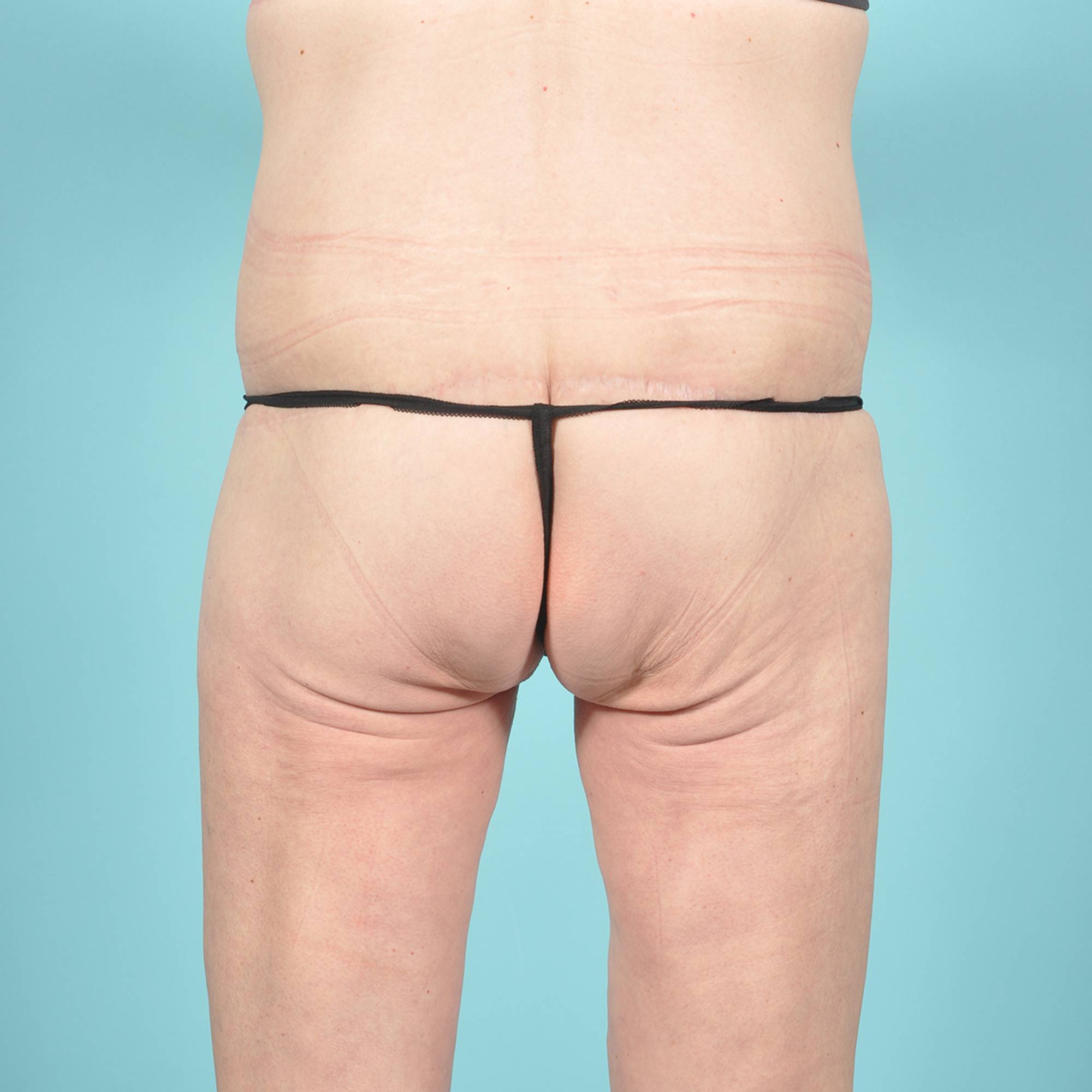  Before & After Image