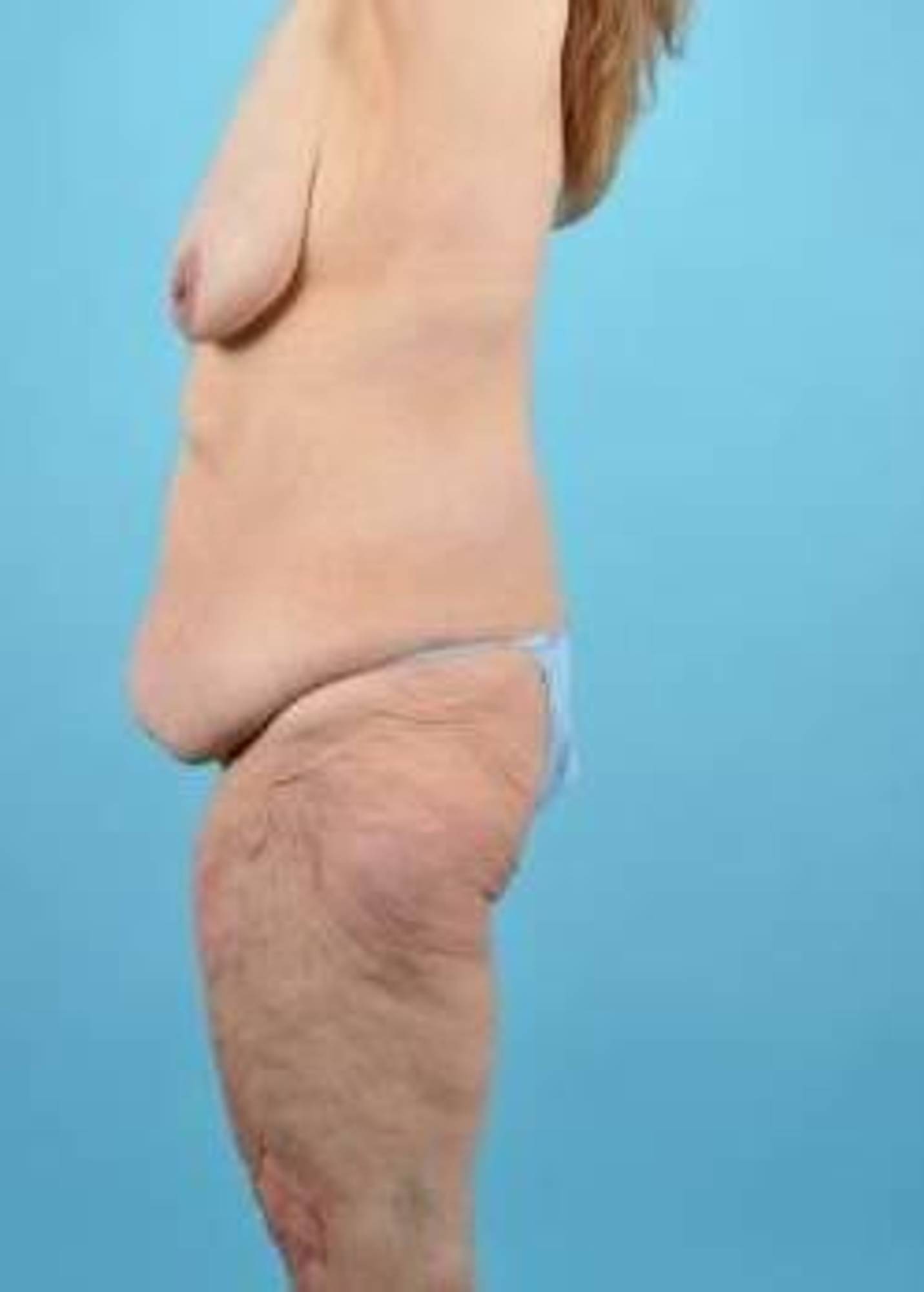  Before & After Image