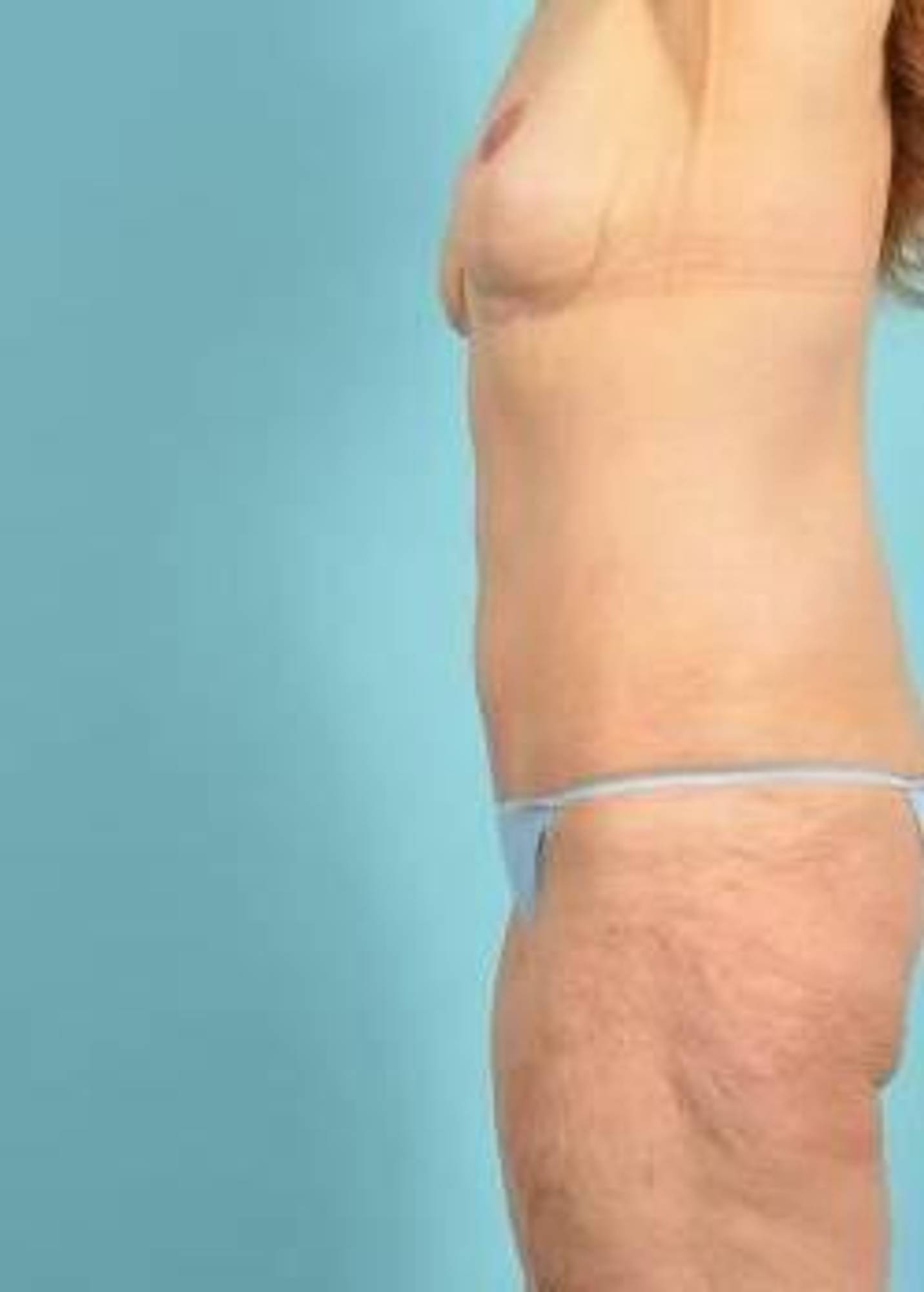  Before & After Image