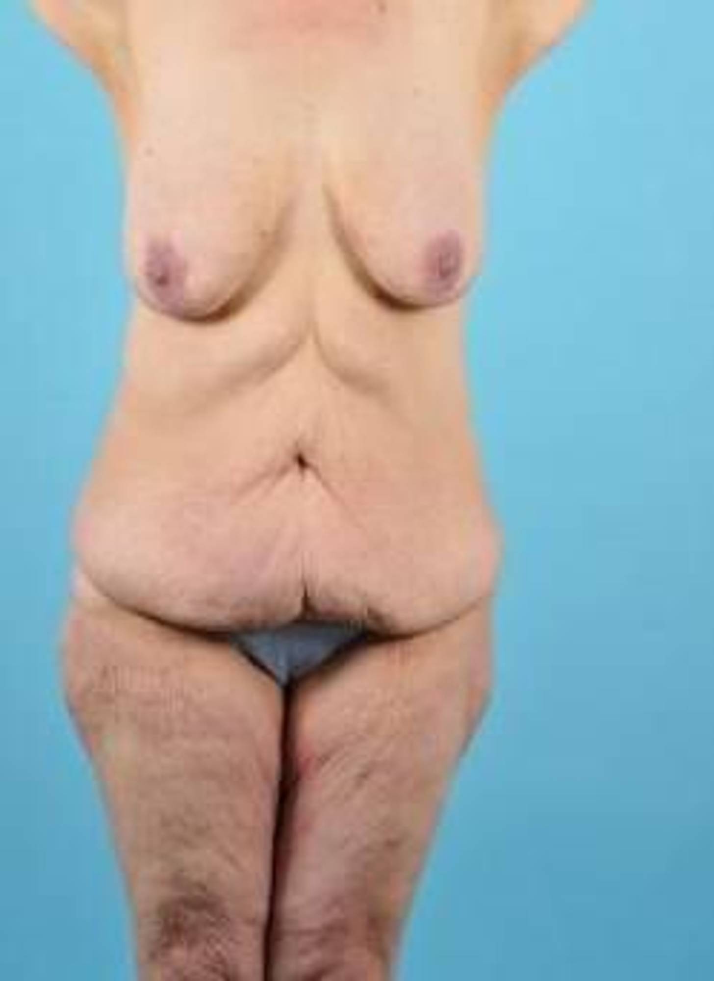  Before & After Image