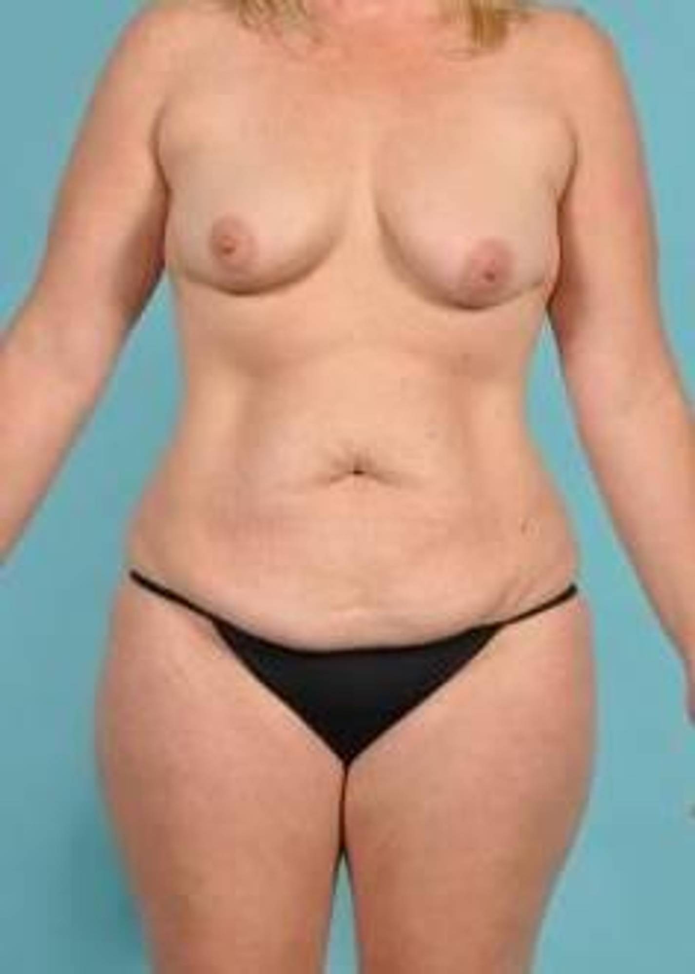  Before & After Image