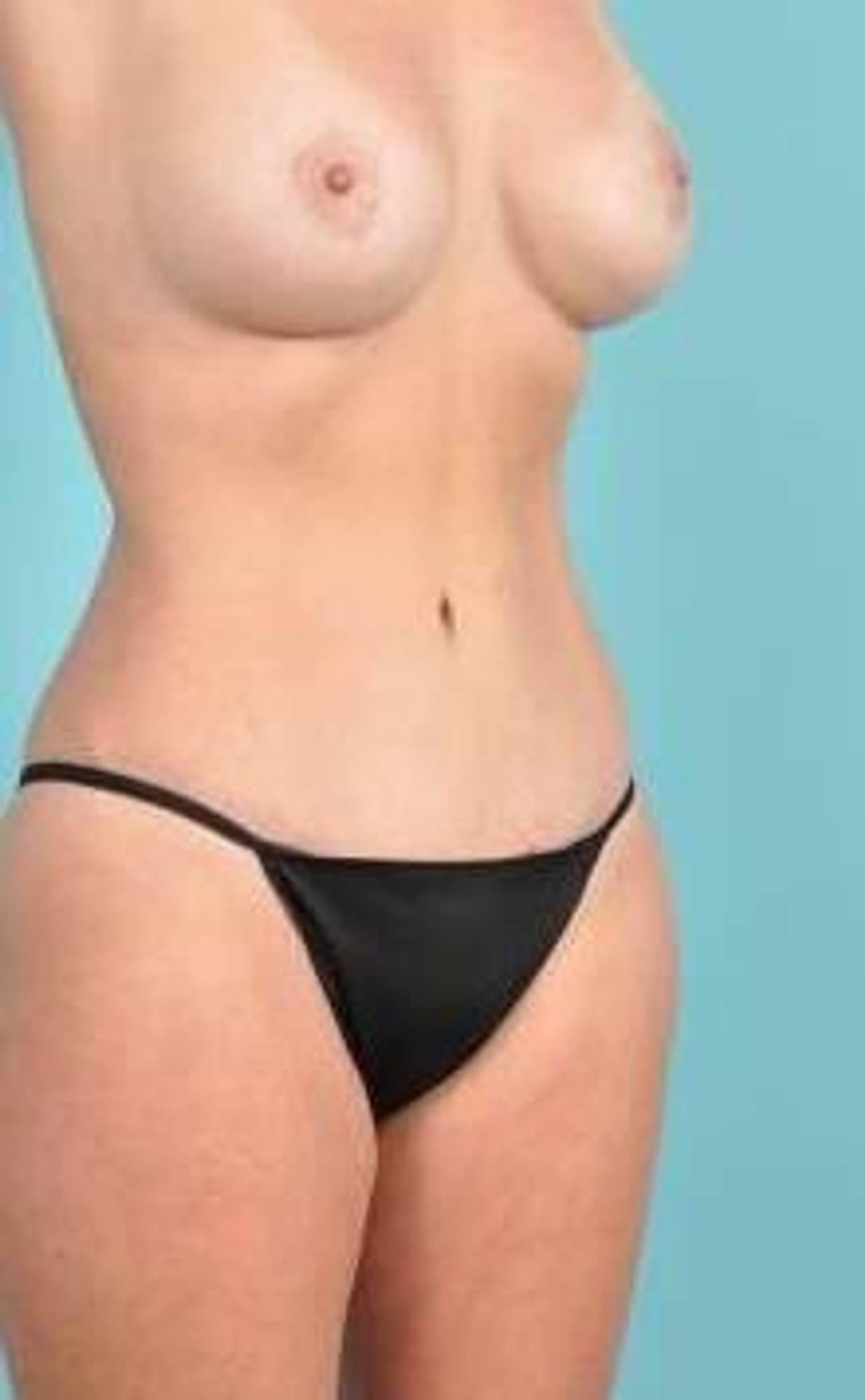  Before & After Image