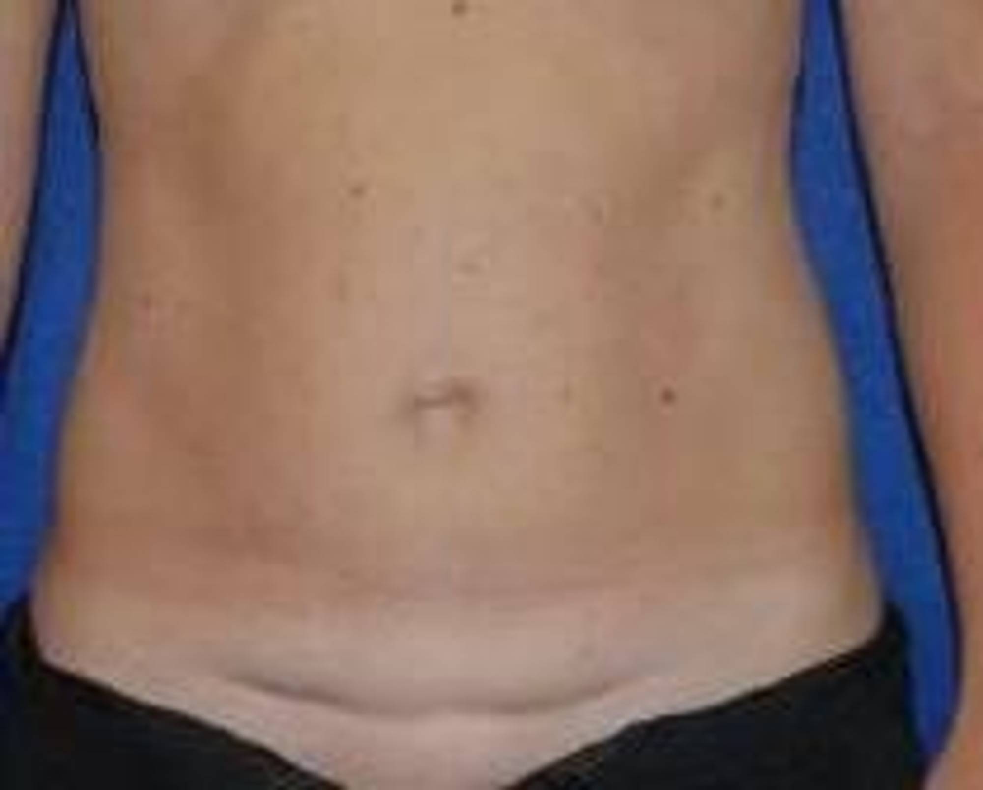  Before & After Image