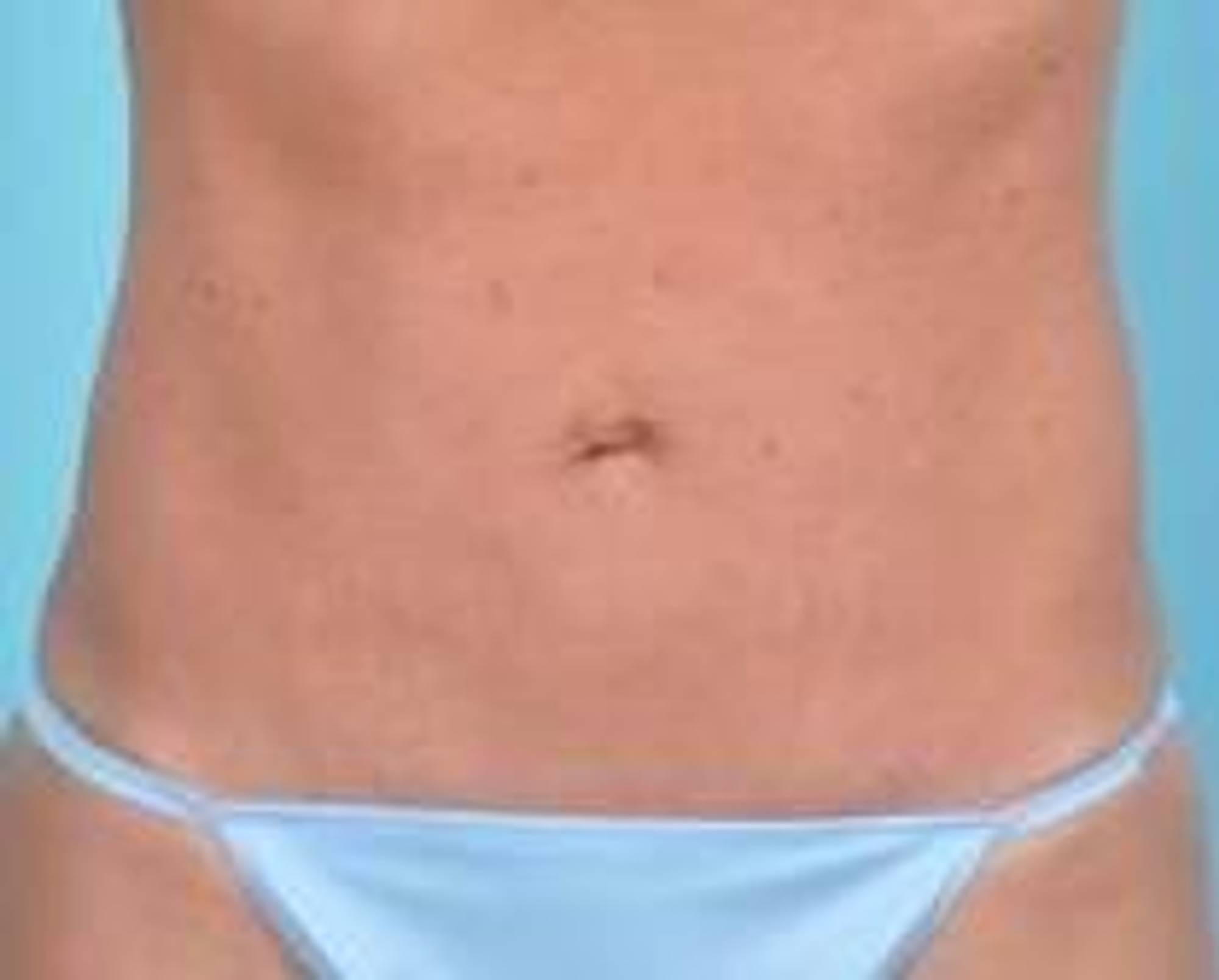  Before & After Image