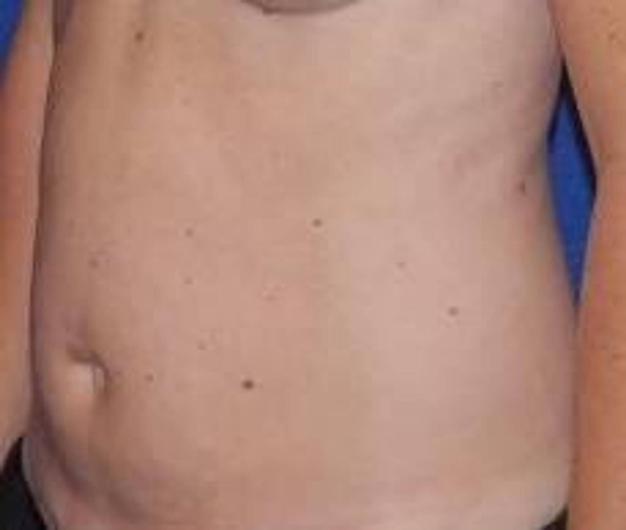  Before & After Image