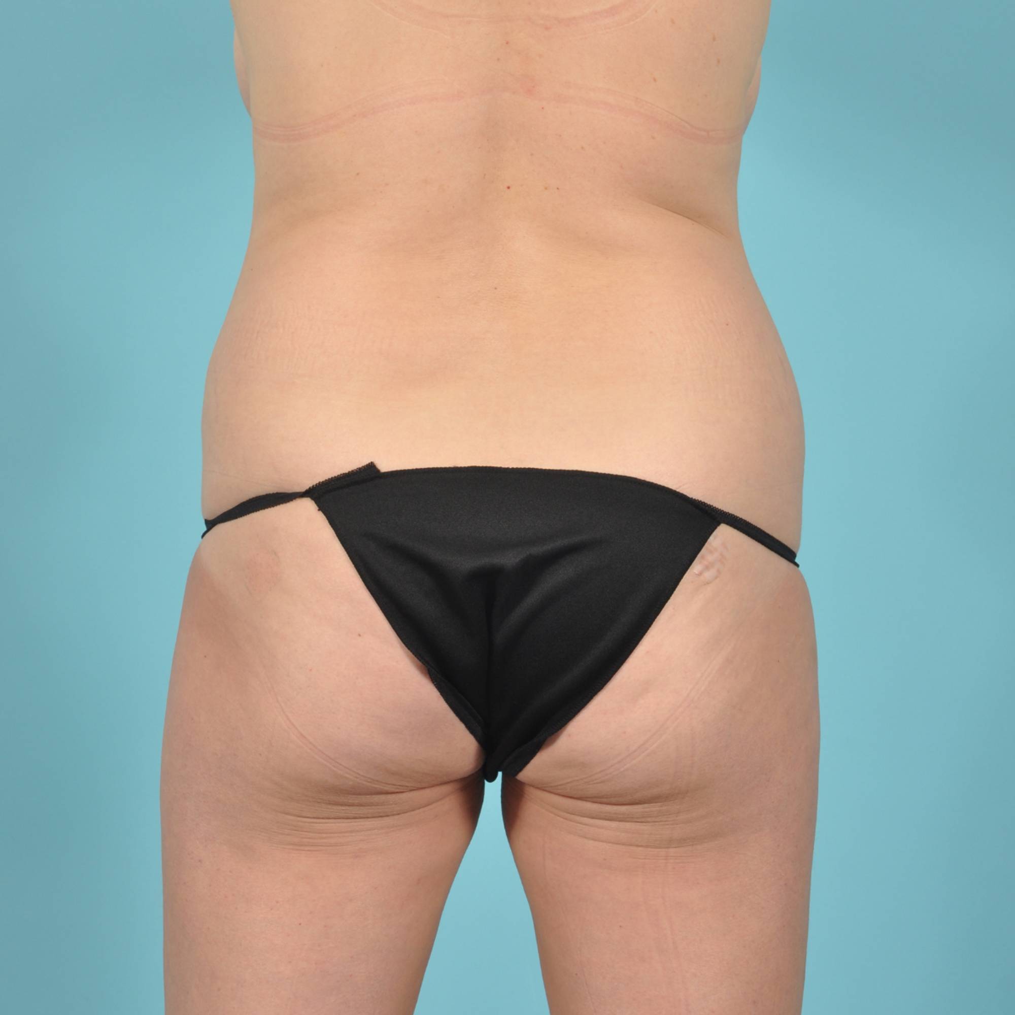  Before & After Image