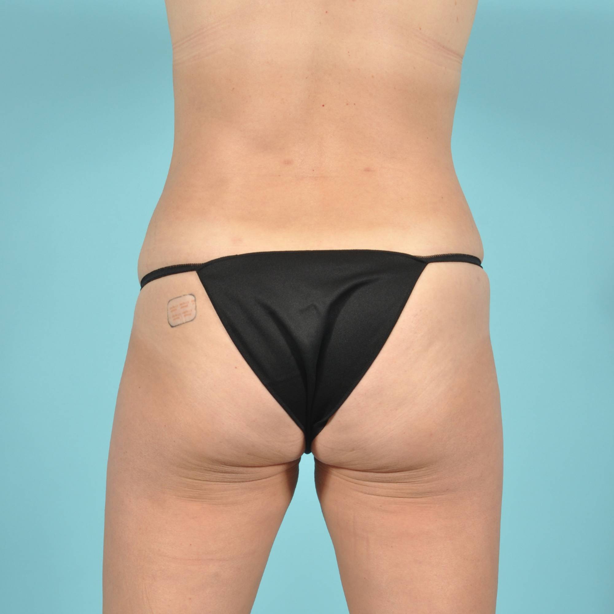  Before & After Image