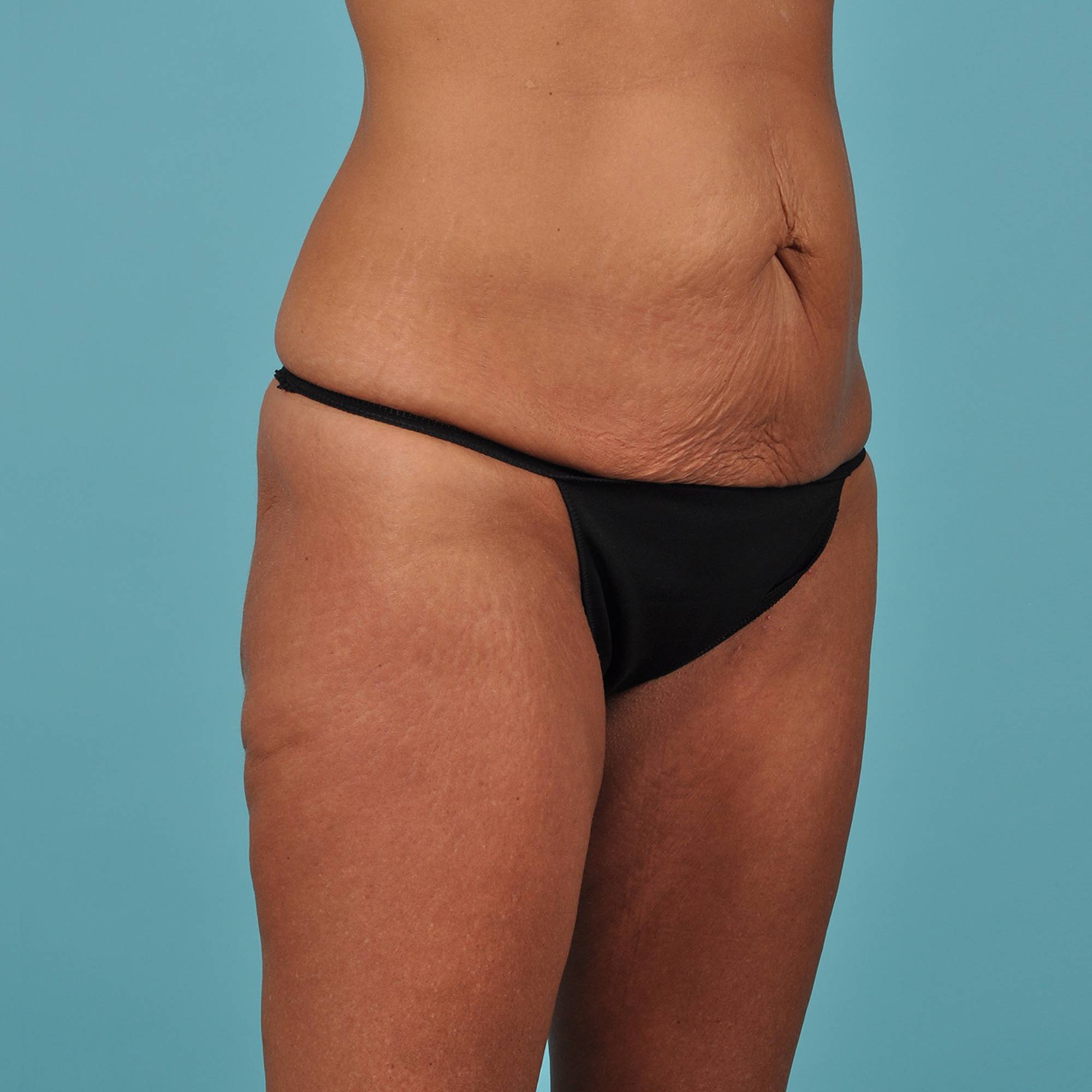  Before & After Image