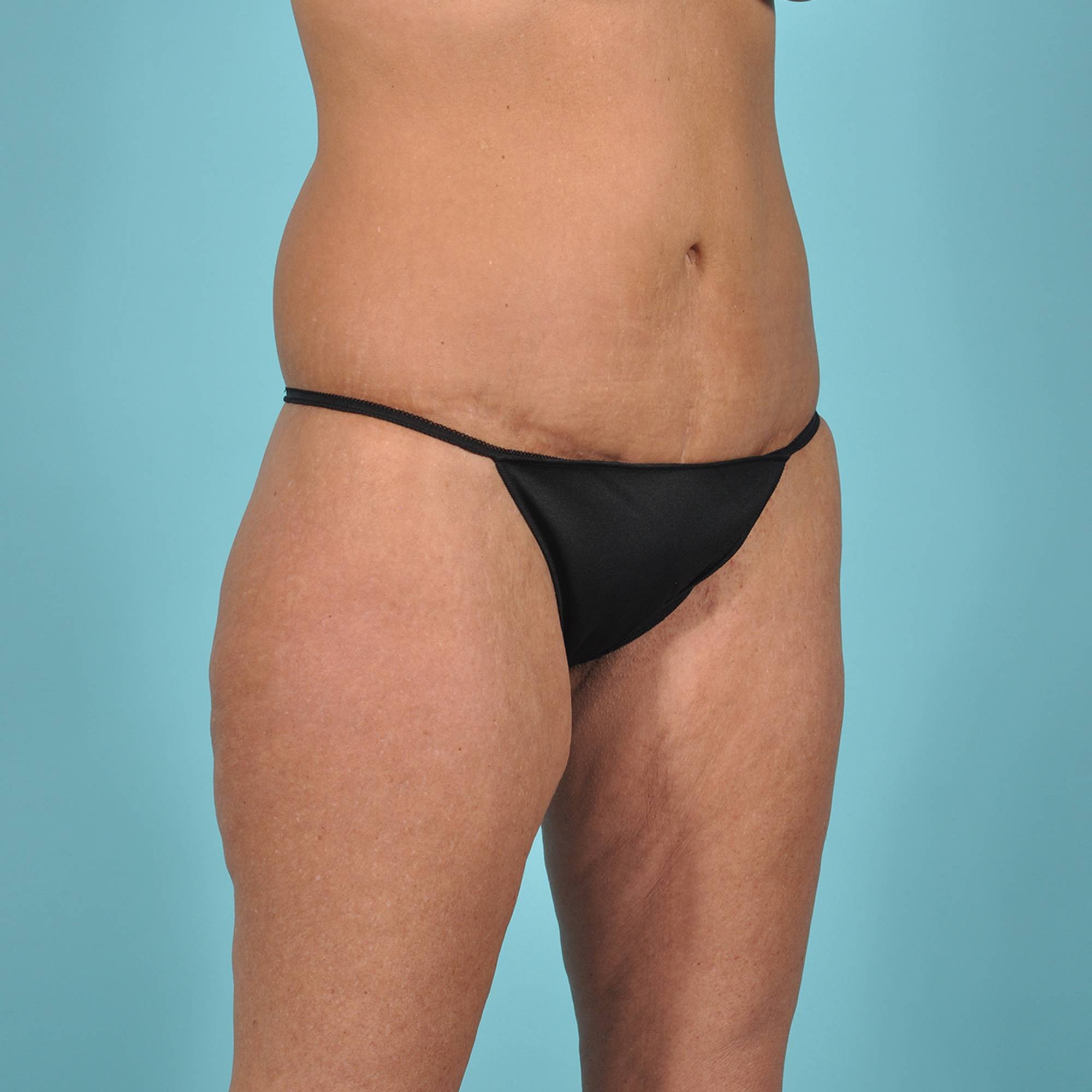  Before & After Image