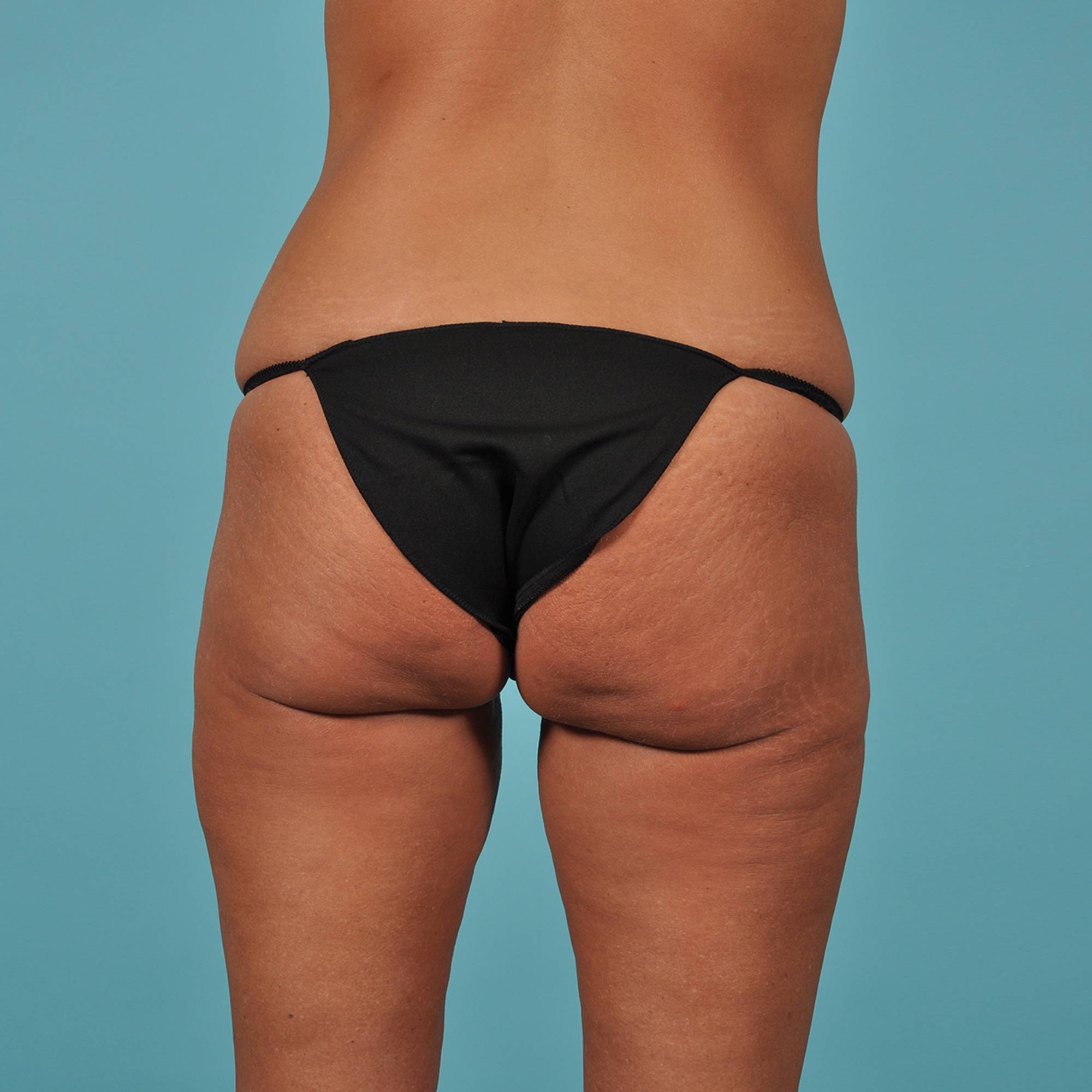  Before & After Image