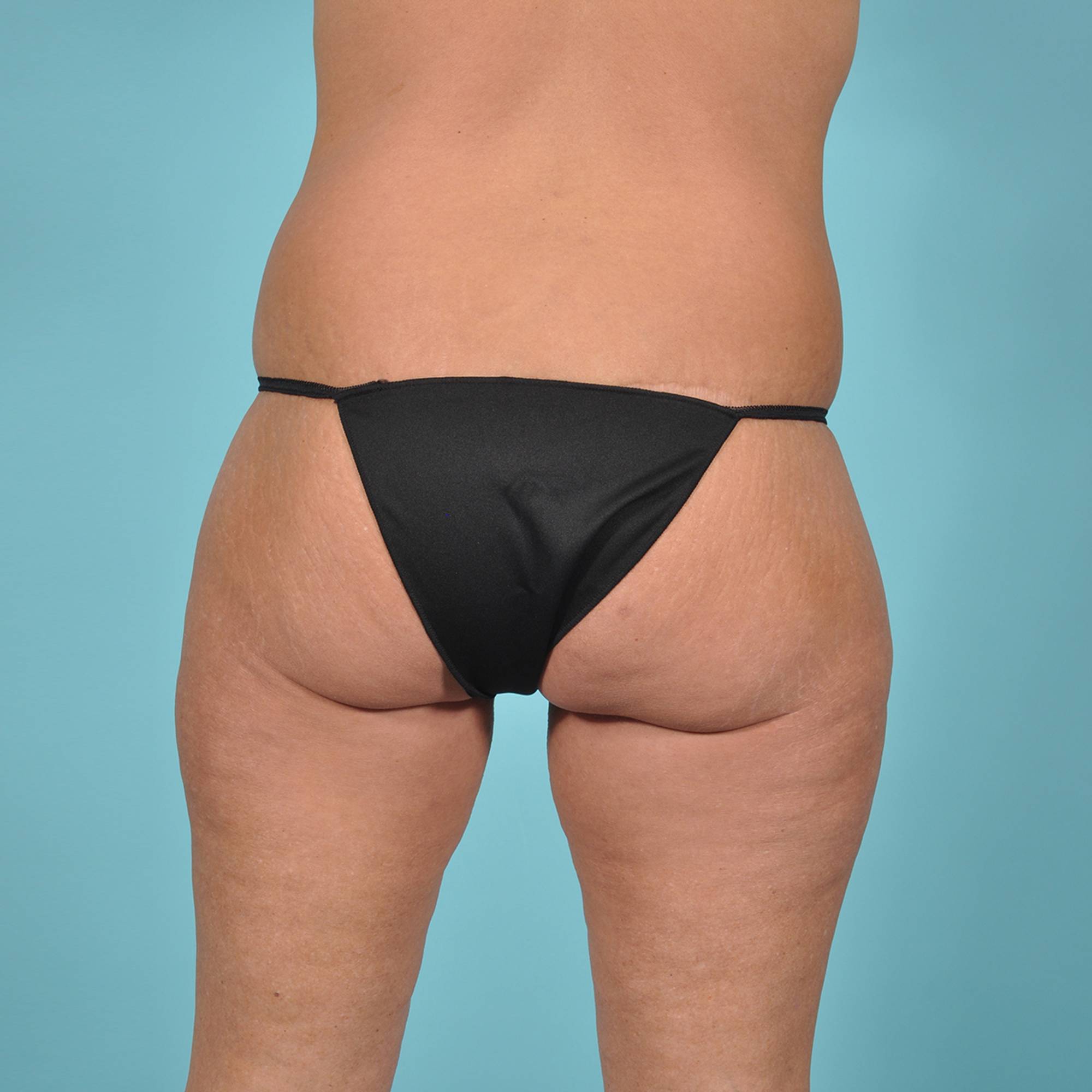  Before & After Image