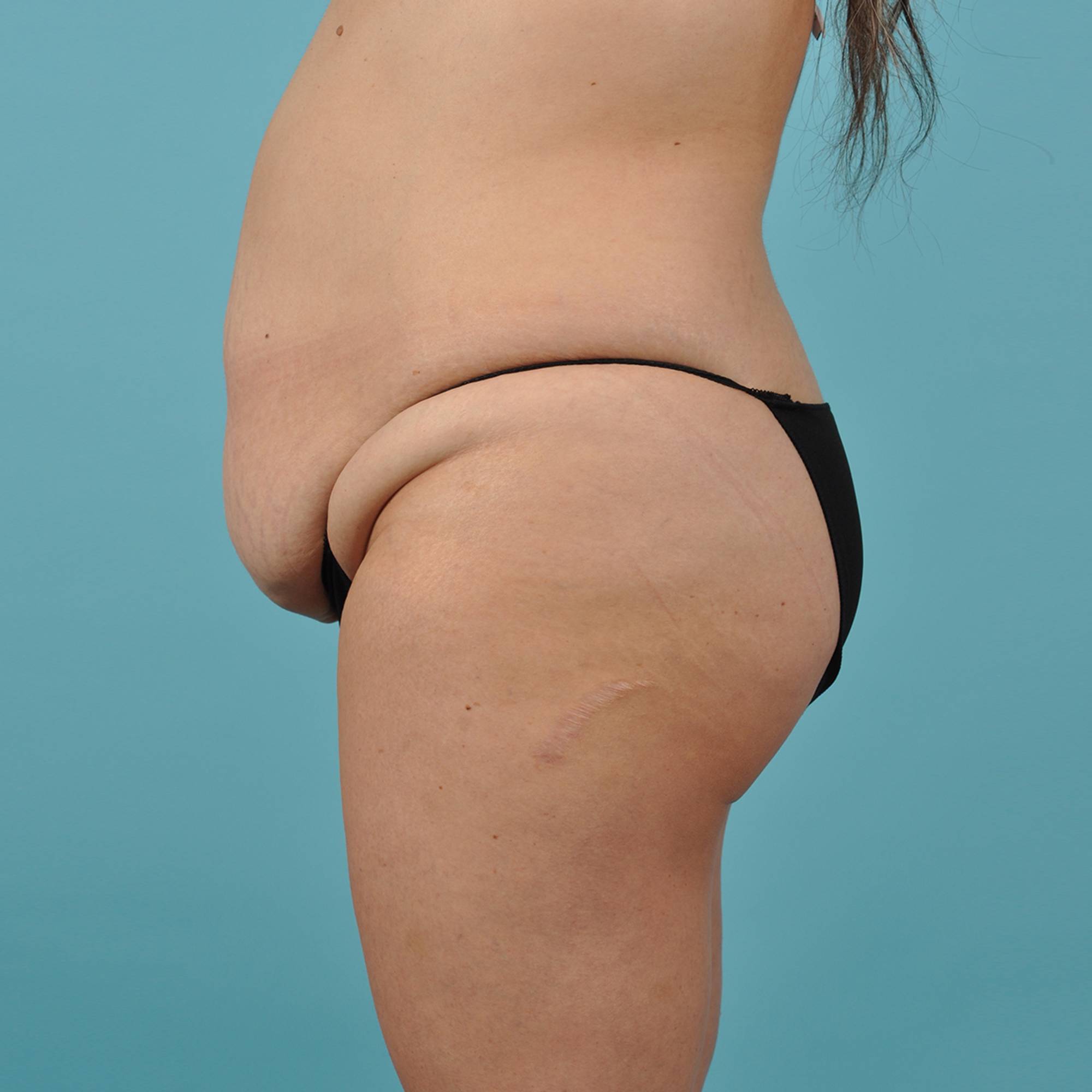  Before & After Image