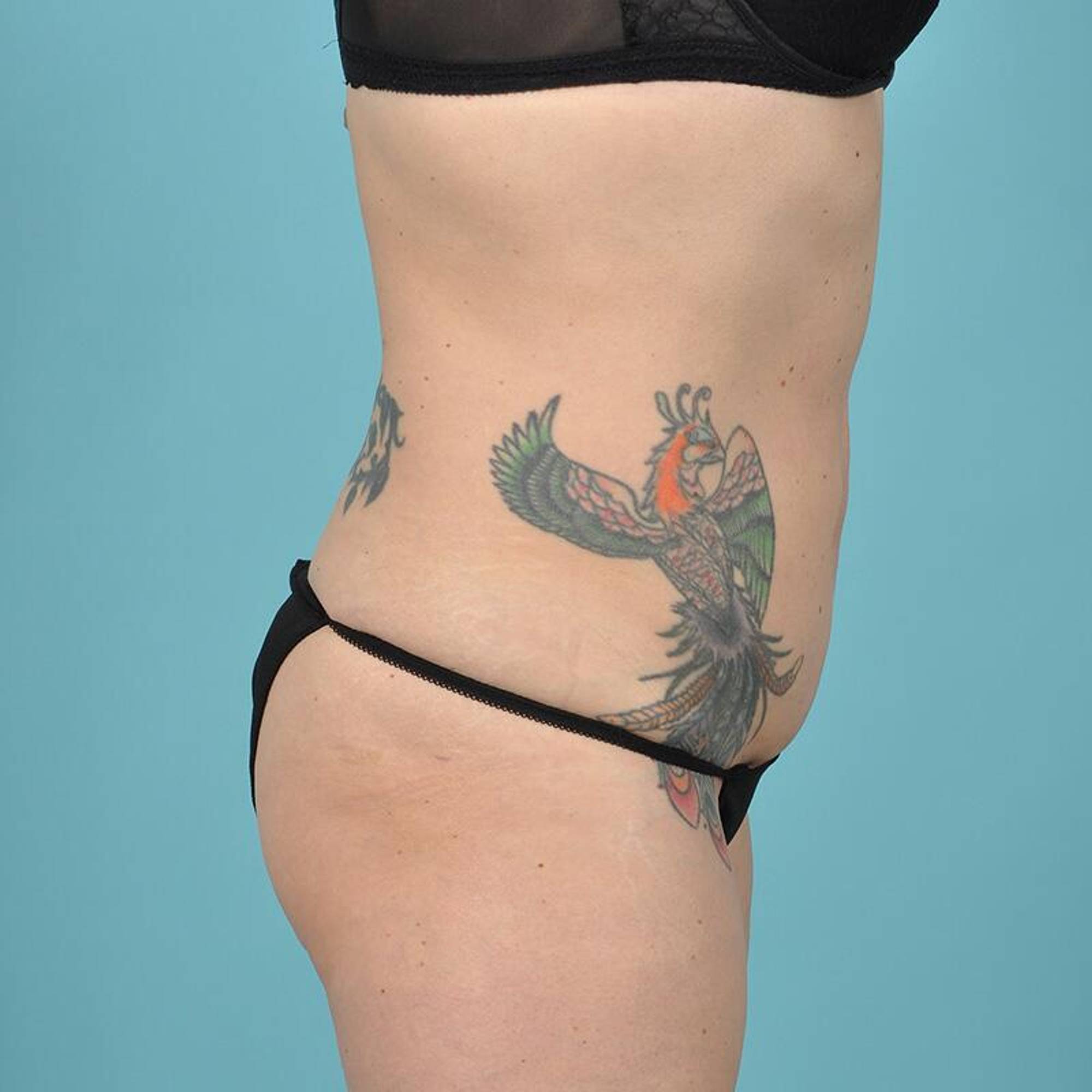  Before & After Image