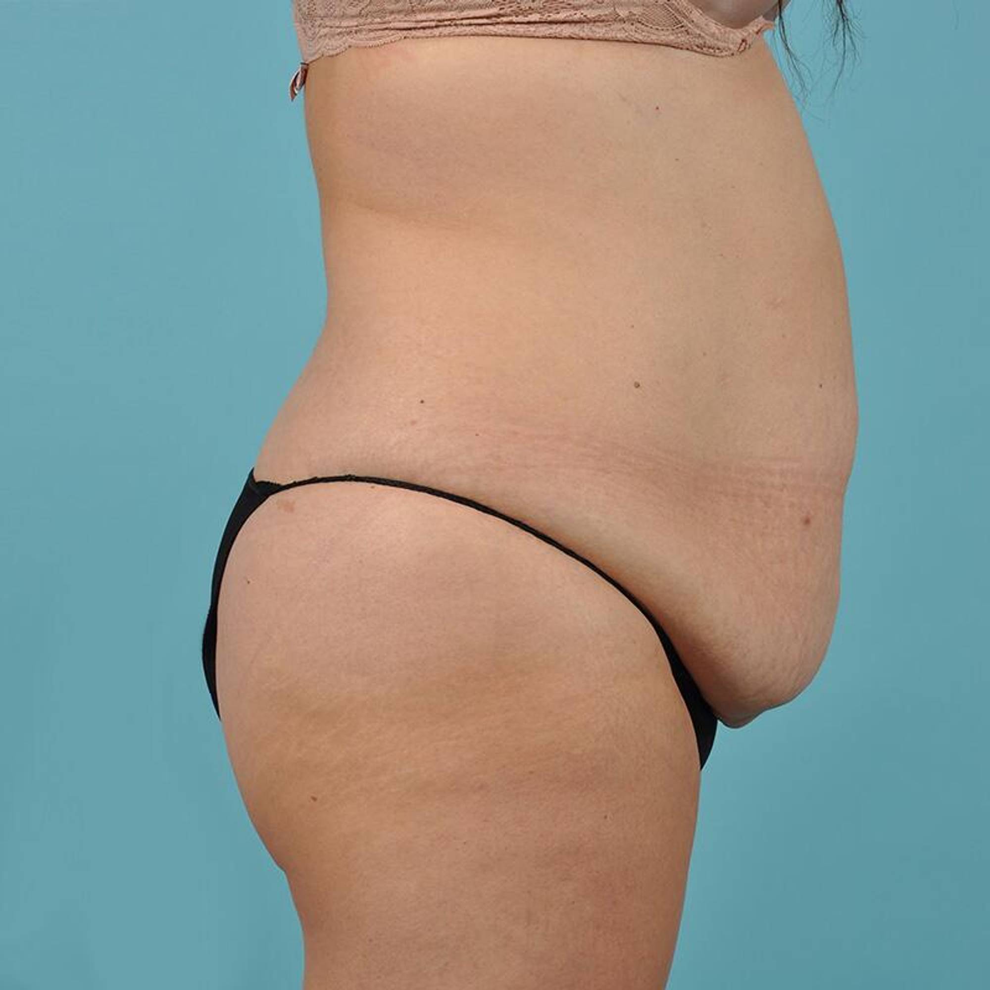  Before & After Image