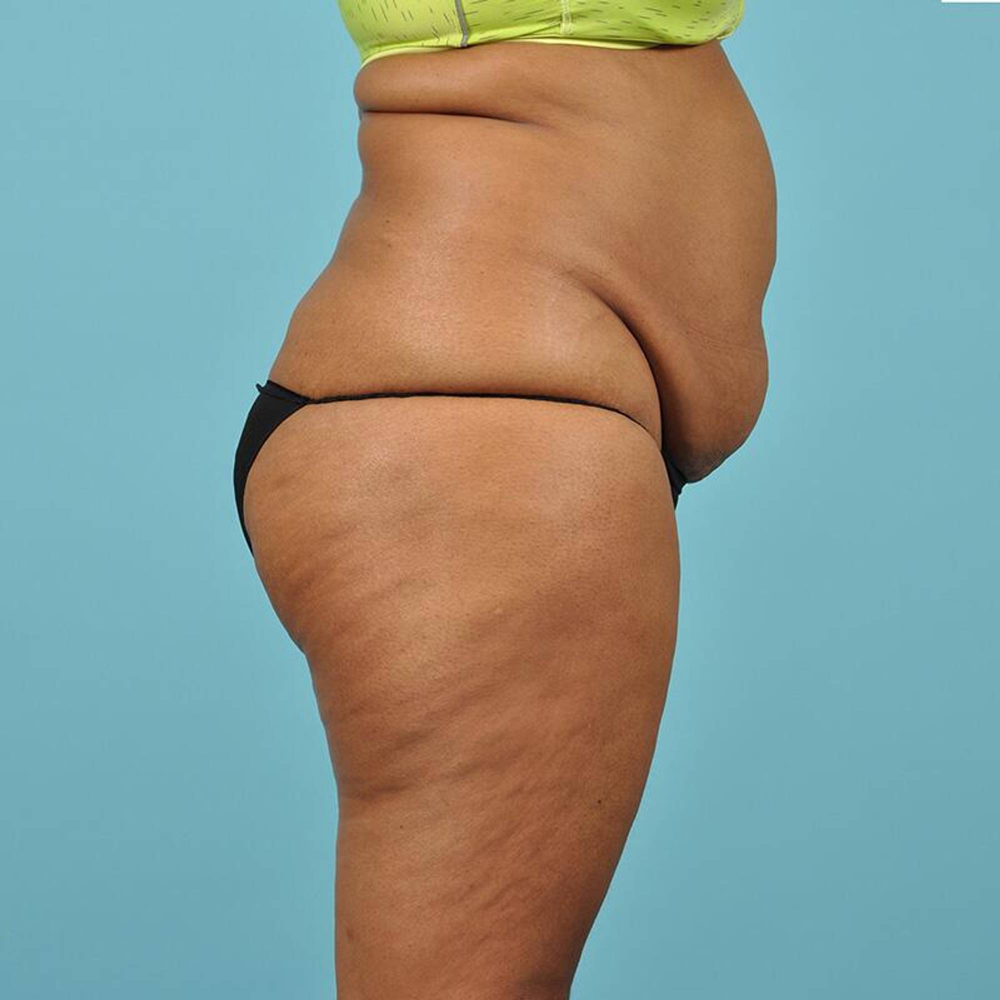  Before & After Image