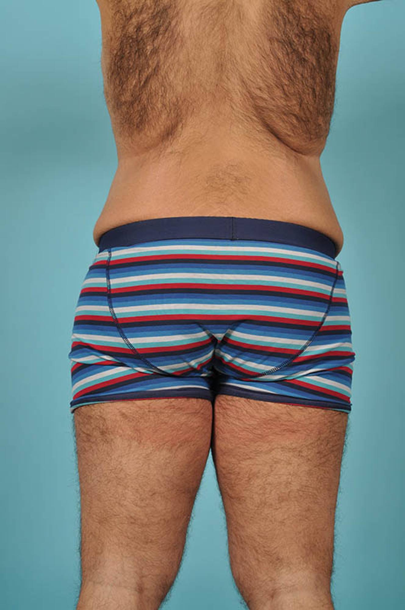  Before & After Image