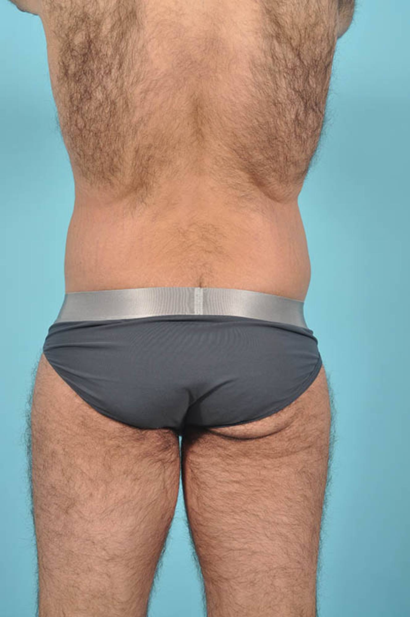  Before & After Image