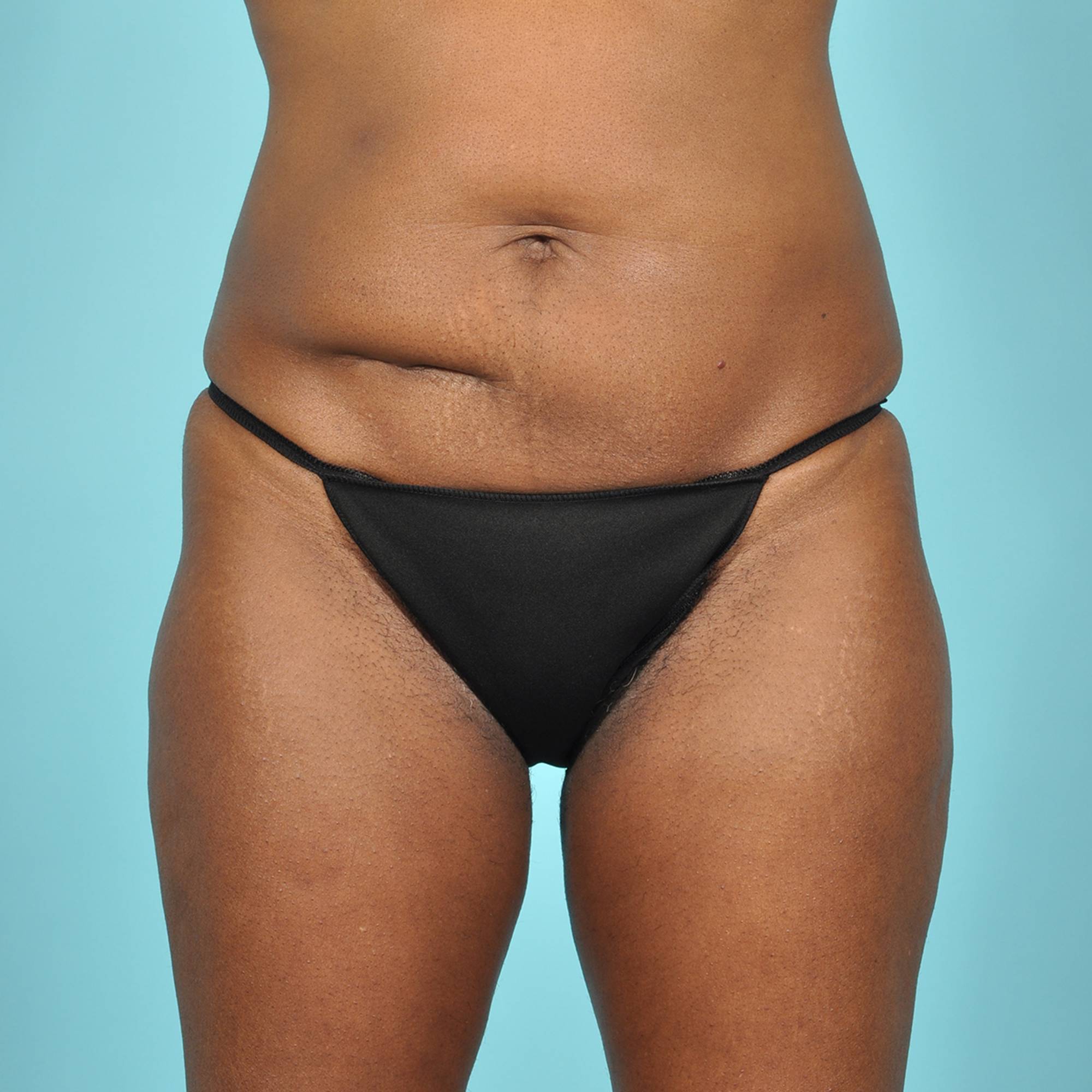  Before & After Image