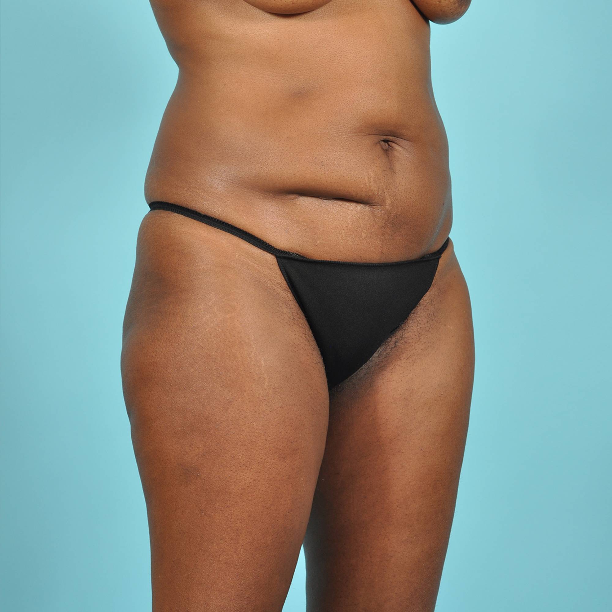  Before & After Image