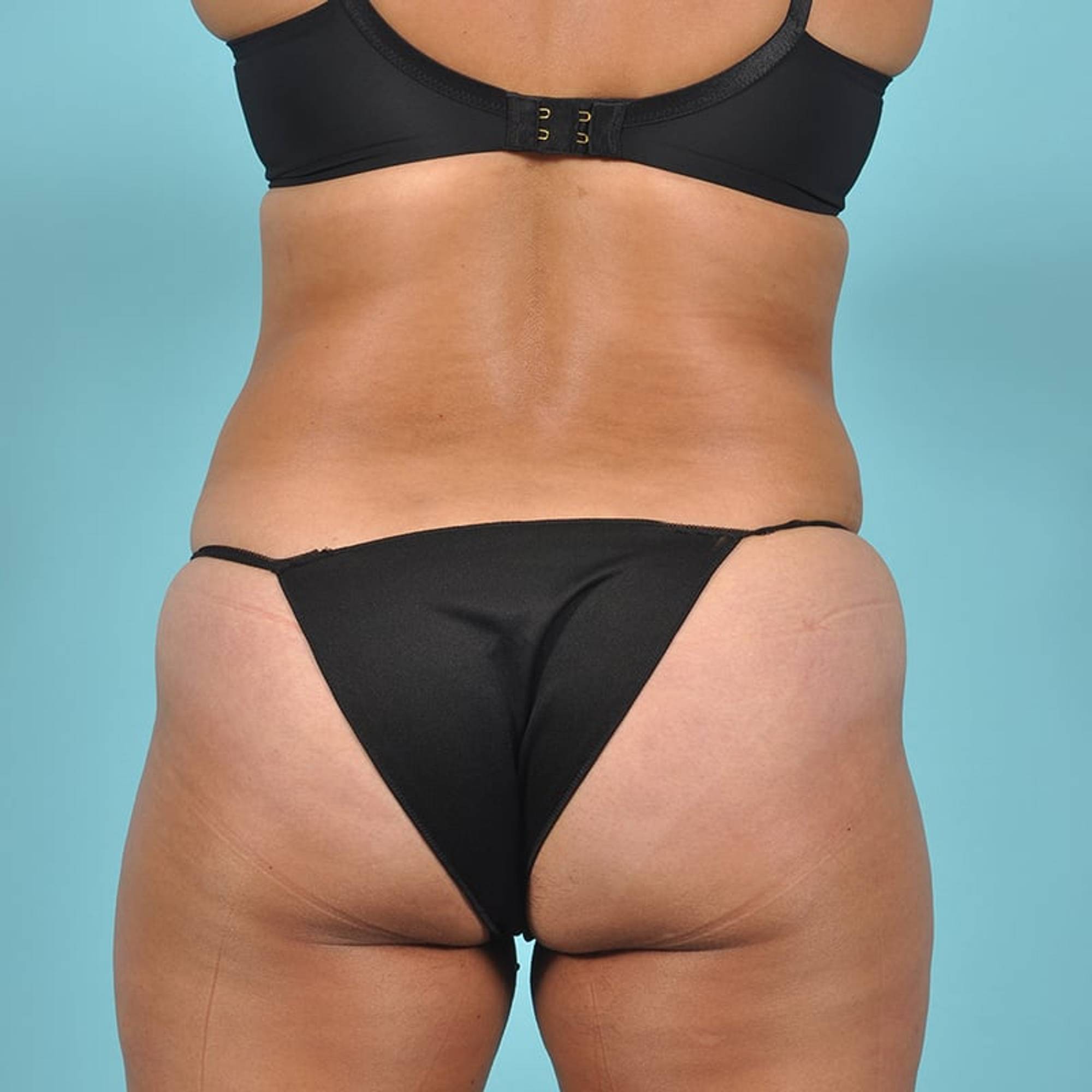  Before & After Image